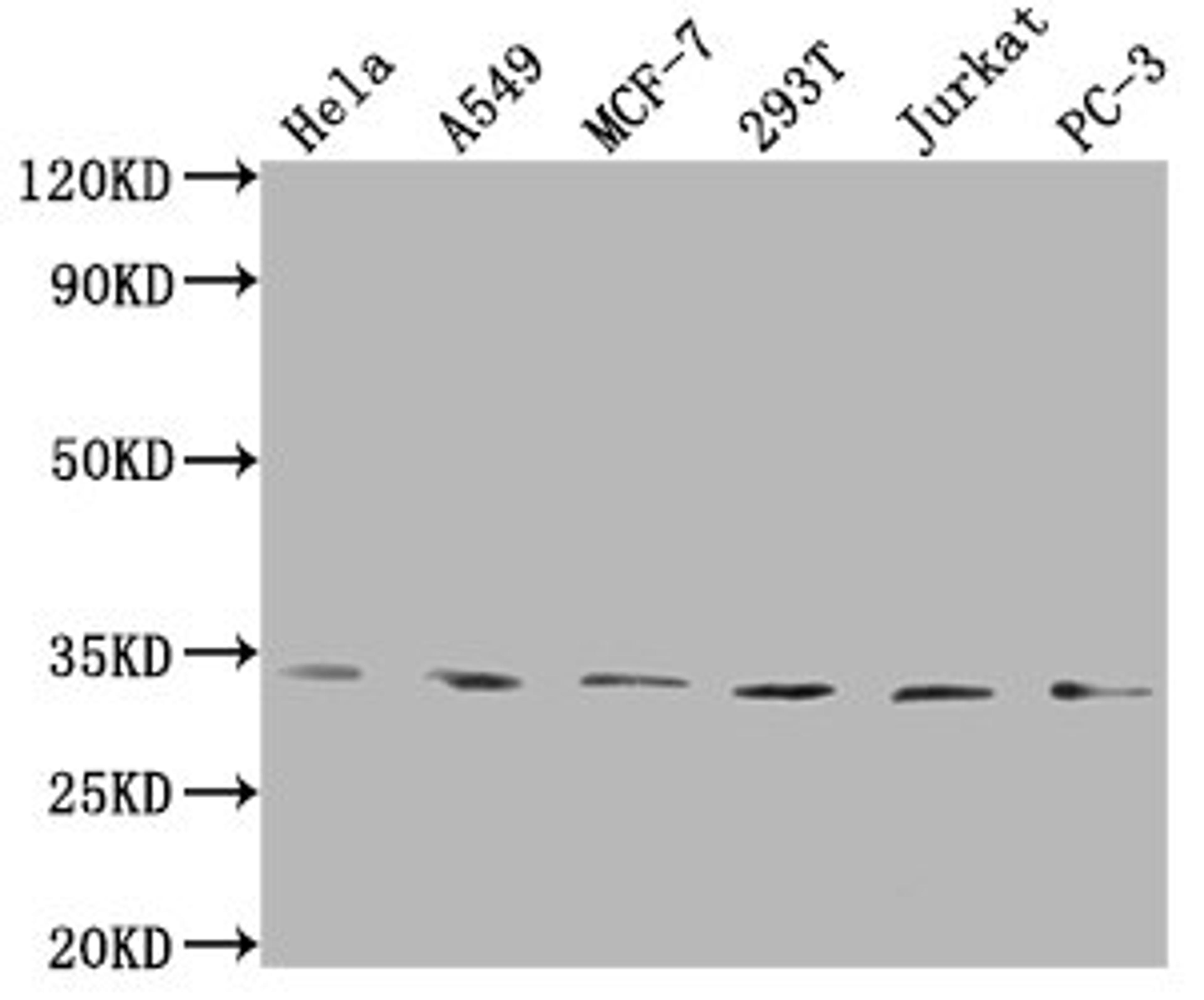 Western Blot. Positive WB detected in: Hela whole cell lysate, A549 whole cell lysate, MCF-7 whole cell lysate, 293T whole cell lysate, Jurkat whole cell lysate, PC-3 whole cell lysate. All lanes: ZNF346 antibody at 1:1000. Secondary. Goat polyclonal to rabbit IgG at 1/50000 dilution. Predicted band size: 33, 36, 30 kDa. Observed band size: 33 kDa.