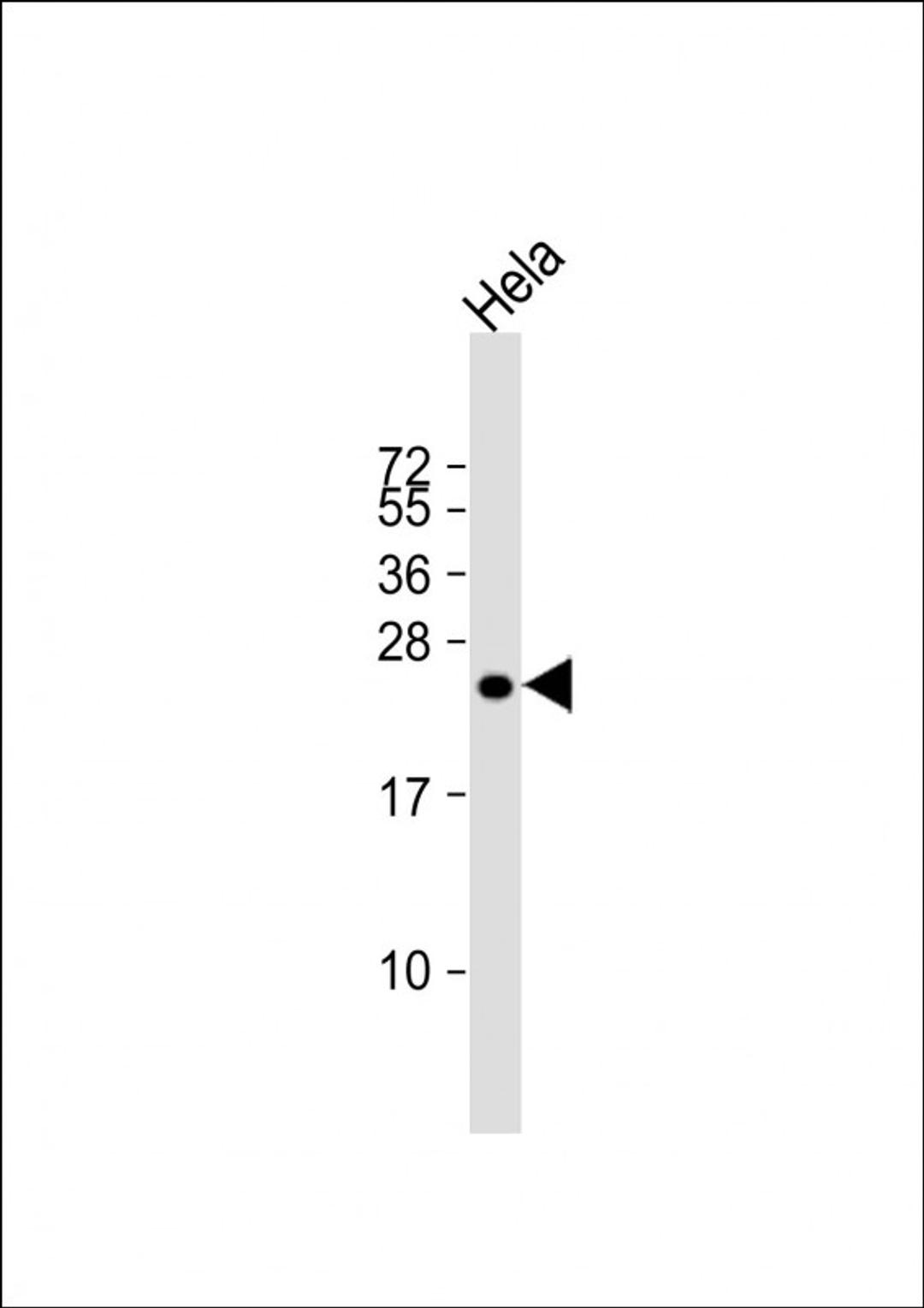 Western Blot at 1:1000 dilution + Hela whole cell lysate Lysates/proteins at 20 ug per lane.