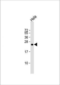 Western Blot at 1:1000 dilution + Hela whole cell lysate Lysates/proteins at 20 ug per lane.