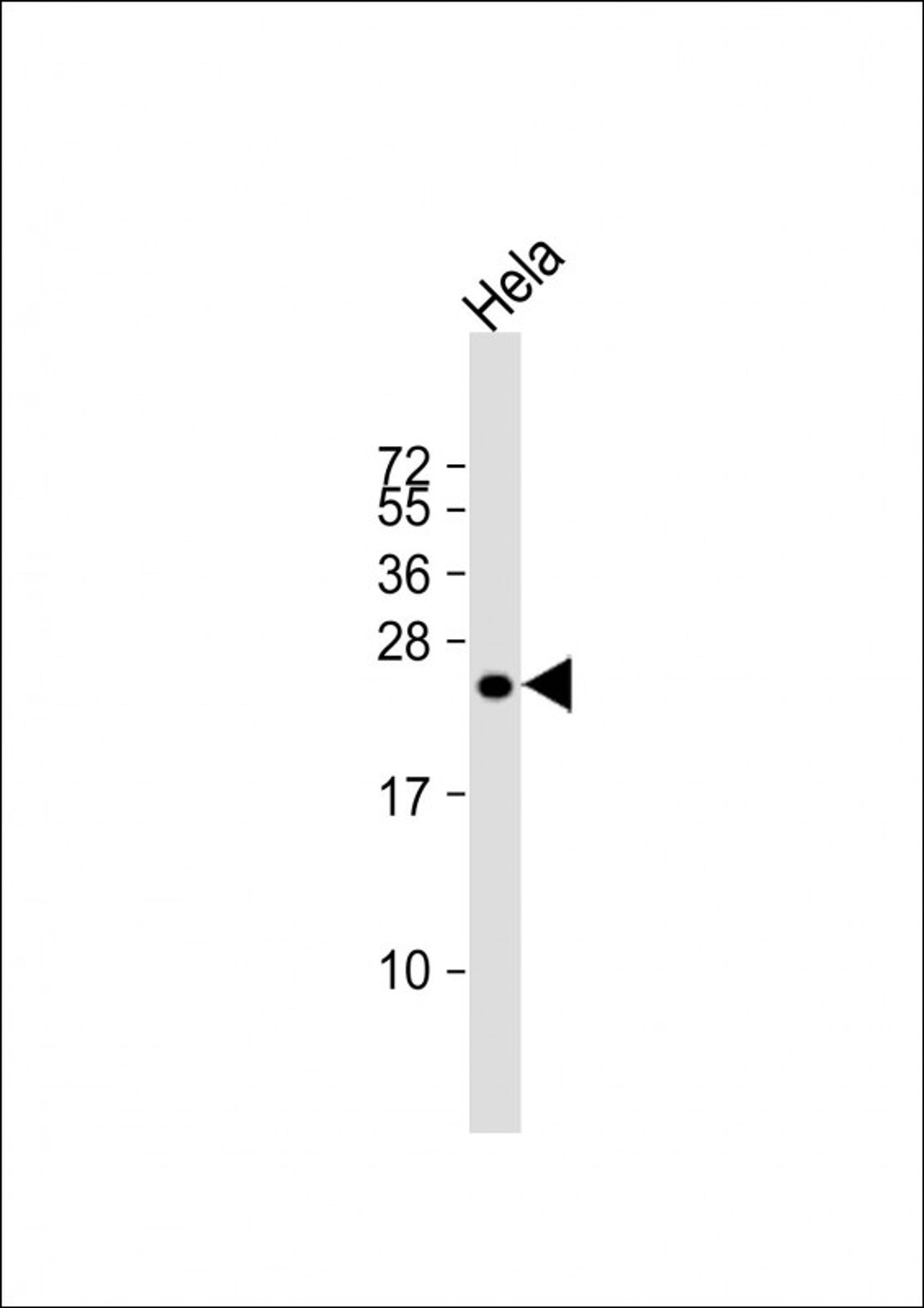 Western Blot at 1:1000 dilution + Hela whole cell lysate Lysates/proteins at 20 ug per lane.