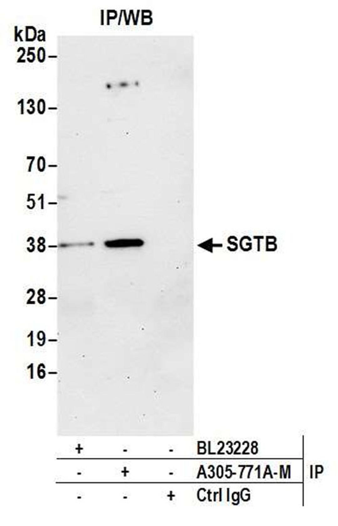 Detection of Human SGTB by WB of IP.