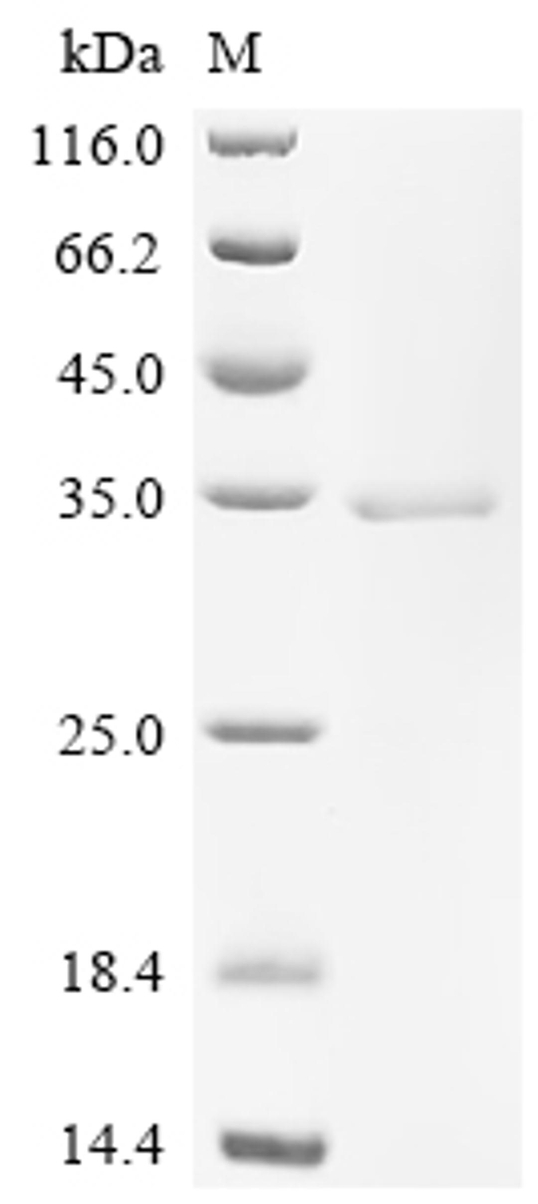 (Tris-Glycine gel) Discontinuous SDS-PAGE (reduced) with 5% enrichment gel and 15% separation gel.