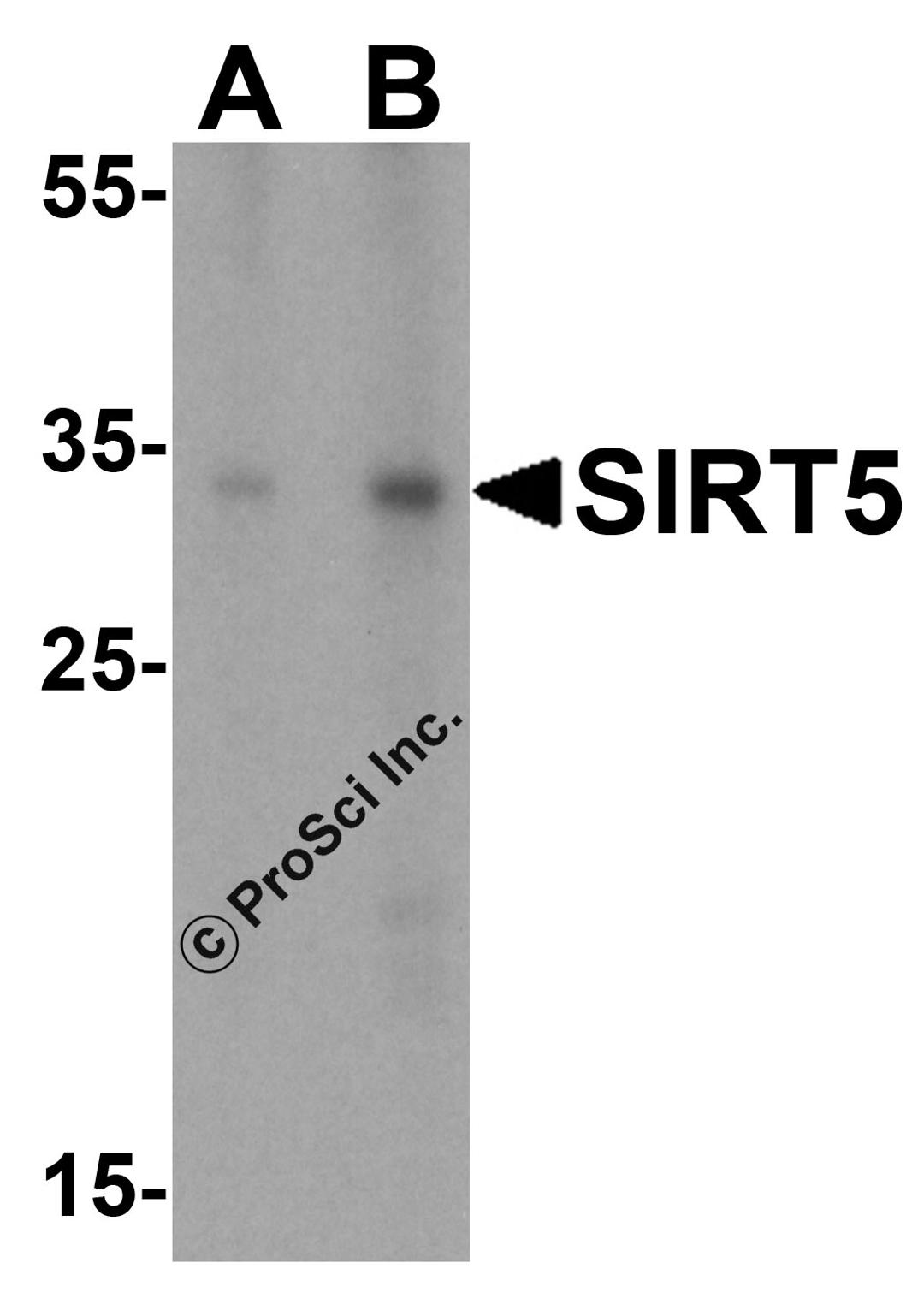 Western blot analysis of SIRT5 in A431 cell lysate with SIRT5 antibody at (A) 1 and (B) 2 μg/mL.