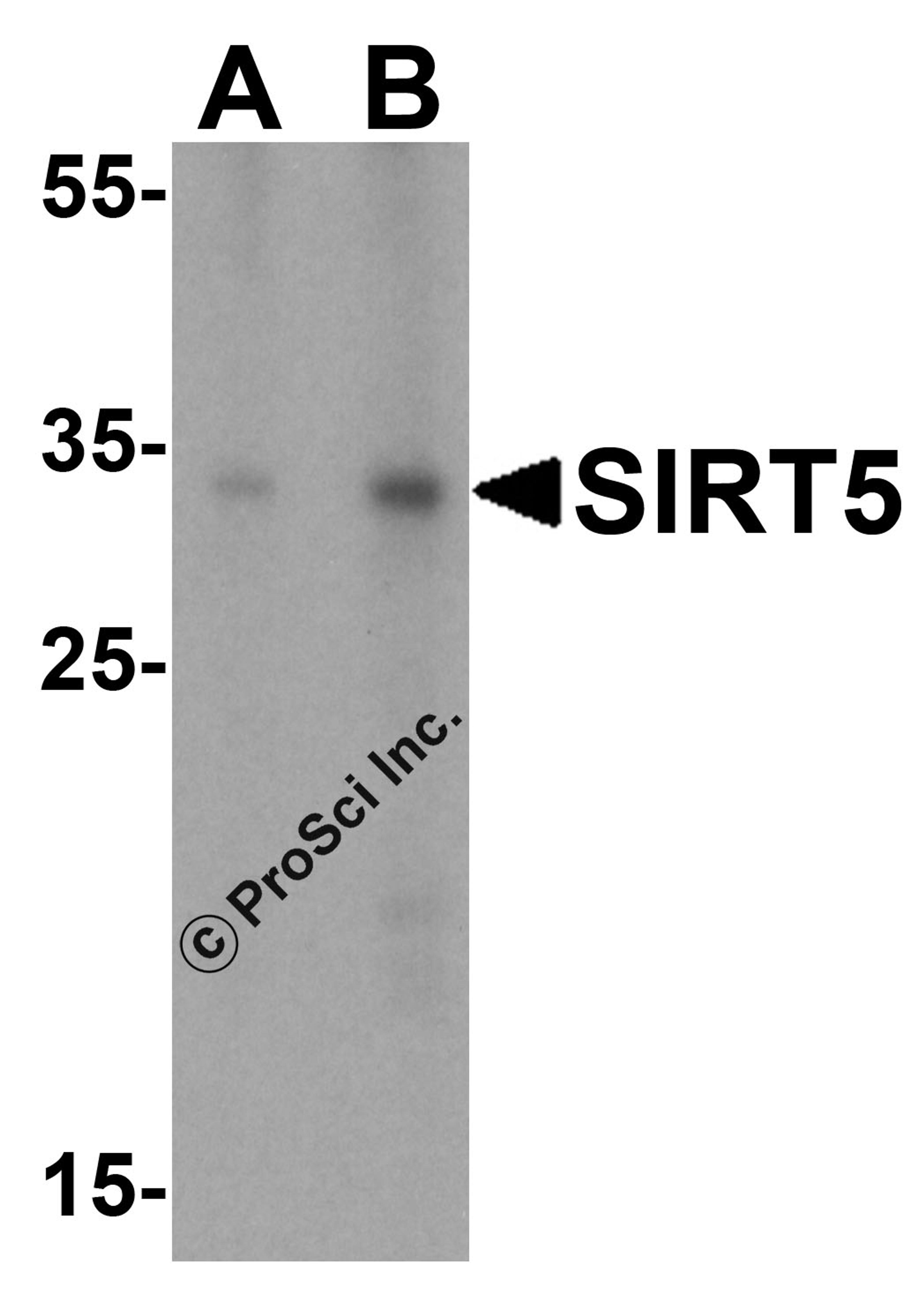 Western blot analysis of SIRT5 in A431 cell lysate with SIRT5 antibody at (A) 1 and (B) 2 μg/mL.