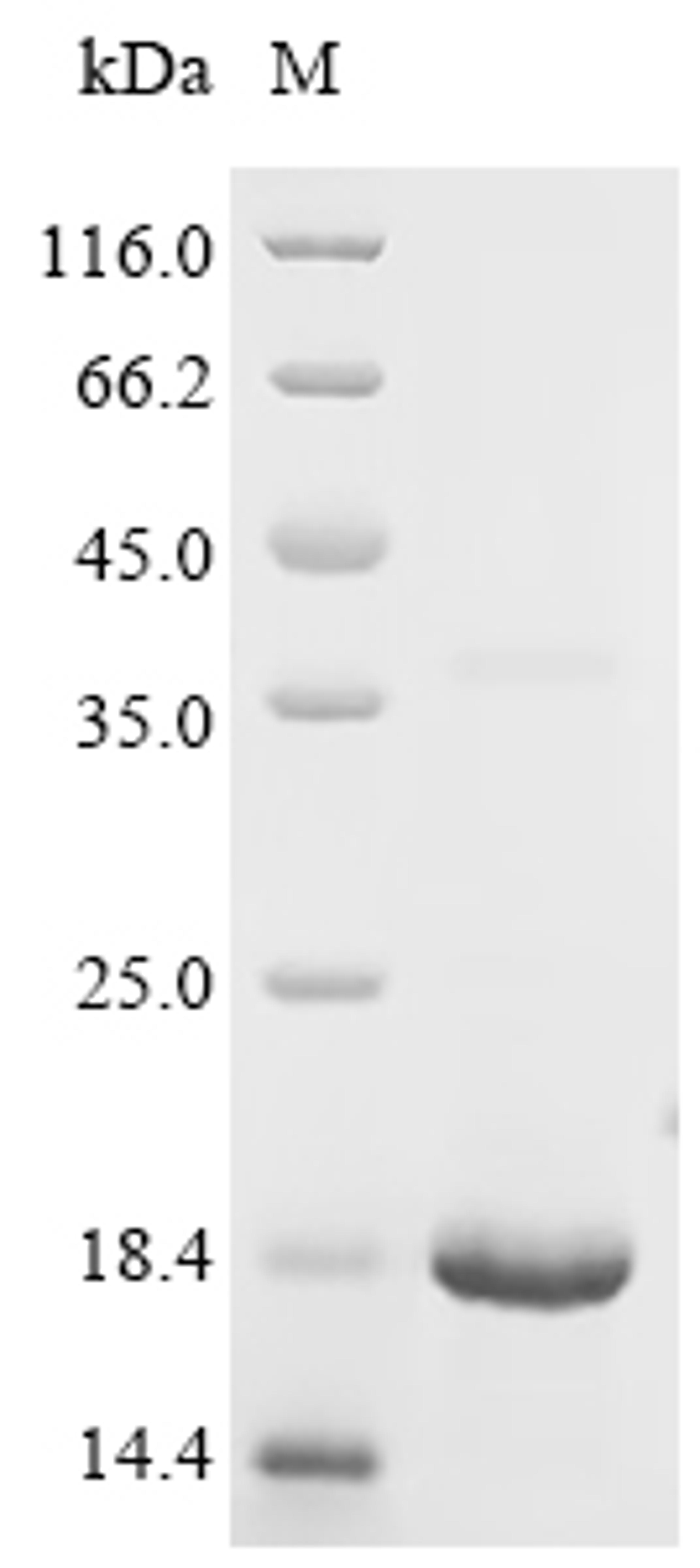 (Tris-Glycine gel) Discontinuous SDS-PAGE (reduced) with 5% enrichment gel and 15% separation gel.