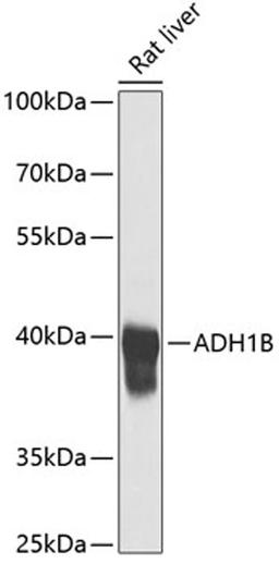 Western blot - ADH1B antibody (A1431)