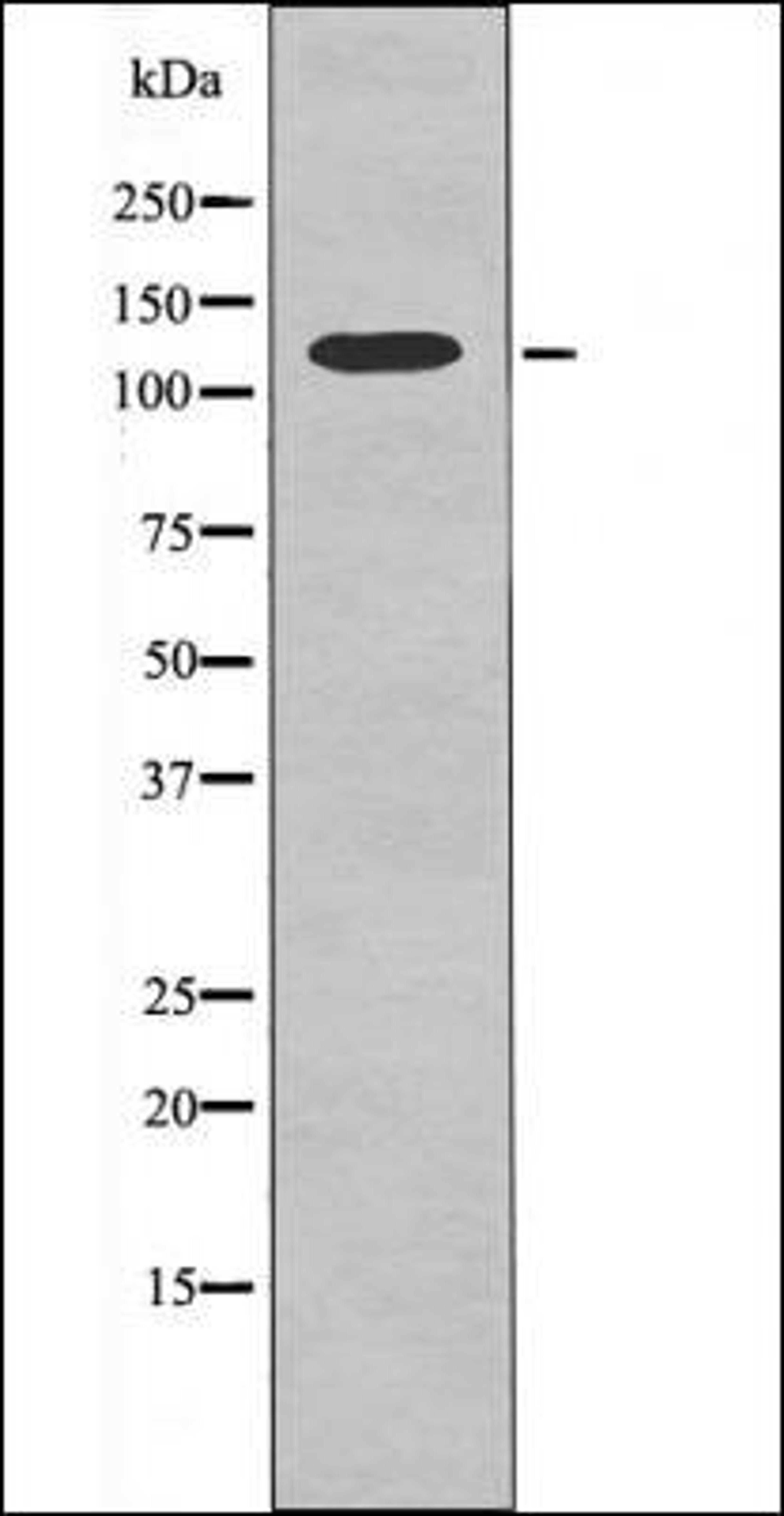 Western blot analysis of PMA treated Jurkat whole cell lysates using KIF1C -Phospho-Ser1092- antibody