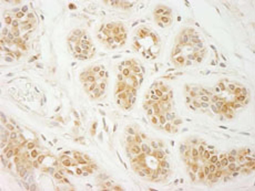 Detection of human eIF2A by immunohistochemistry.