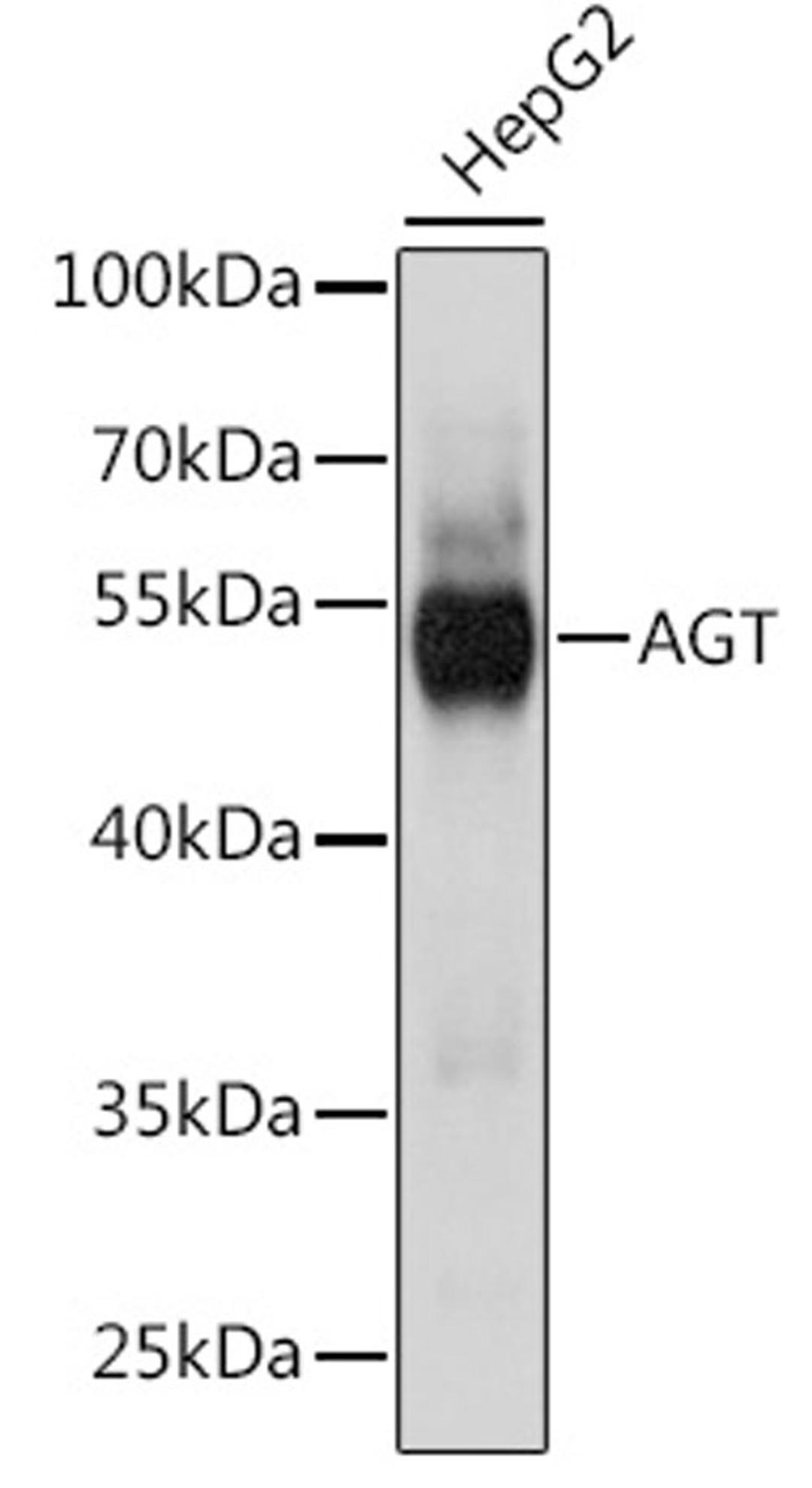 Western blot - AGT antibody (A15637)