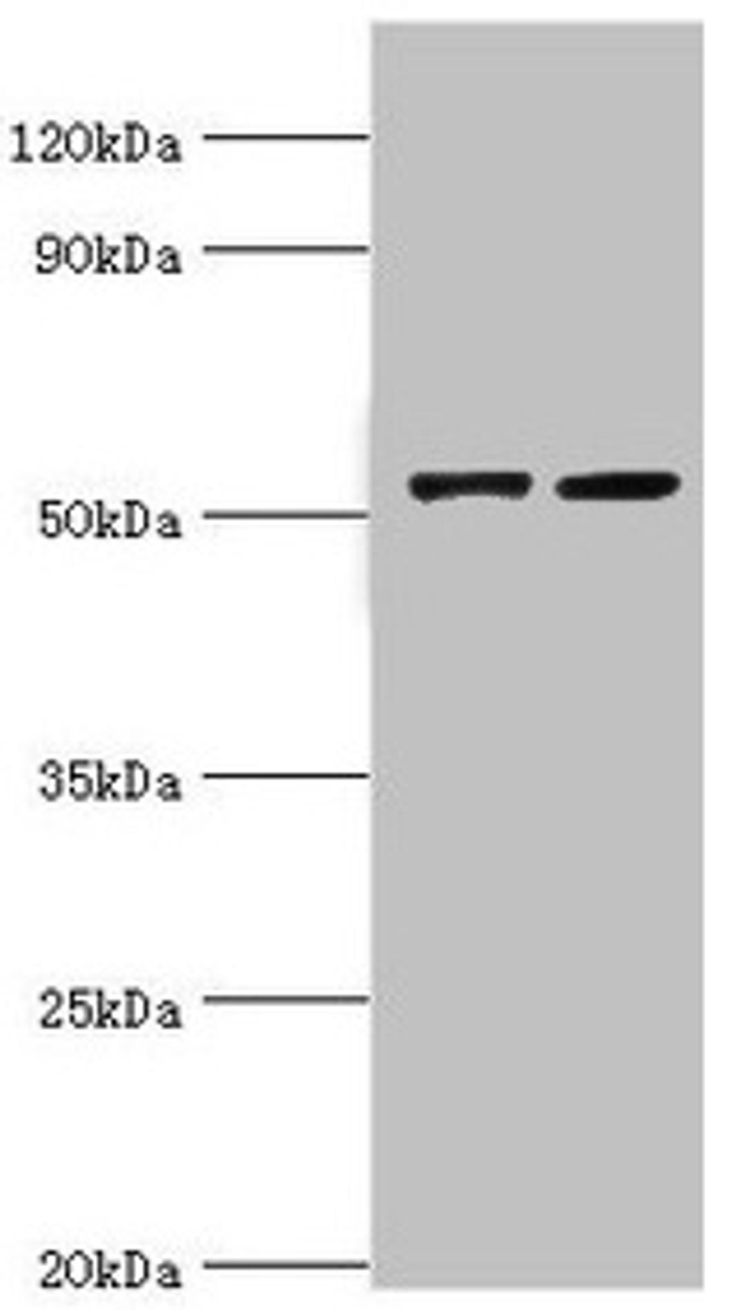 Western blot. All lanes: CBLC antibody at 14µg/ml. Lane 1: A549 whole cell lysate. Lane 2: Hela whole cell lysate. Secondary. Goat polyclonal to rabbit IgG at 1/10000 dilution. Predicted band size: 53, 48 kDa. Observed band size: 53 kDa