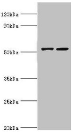 Western blot. All lanes: CBLC antibody at 14µg/ml. Lane 1: A549 whole cell lysate. Lane 2: Hela whole cell lysate. Secondary. Goat polyclonal to rabbit IgG at 1/10000 dilution. Predicted band size: 53, 48 kDa. Observed band size: 53 kDa