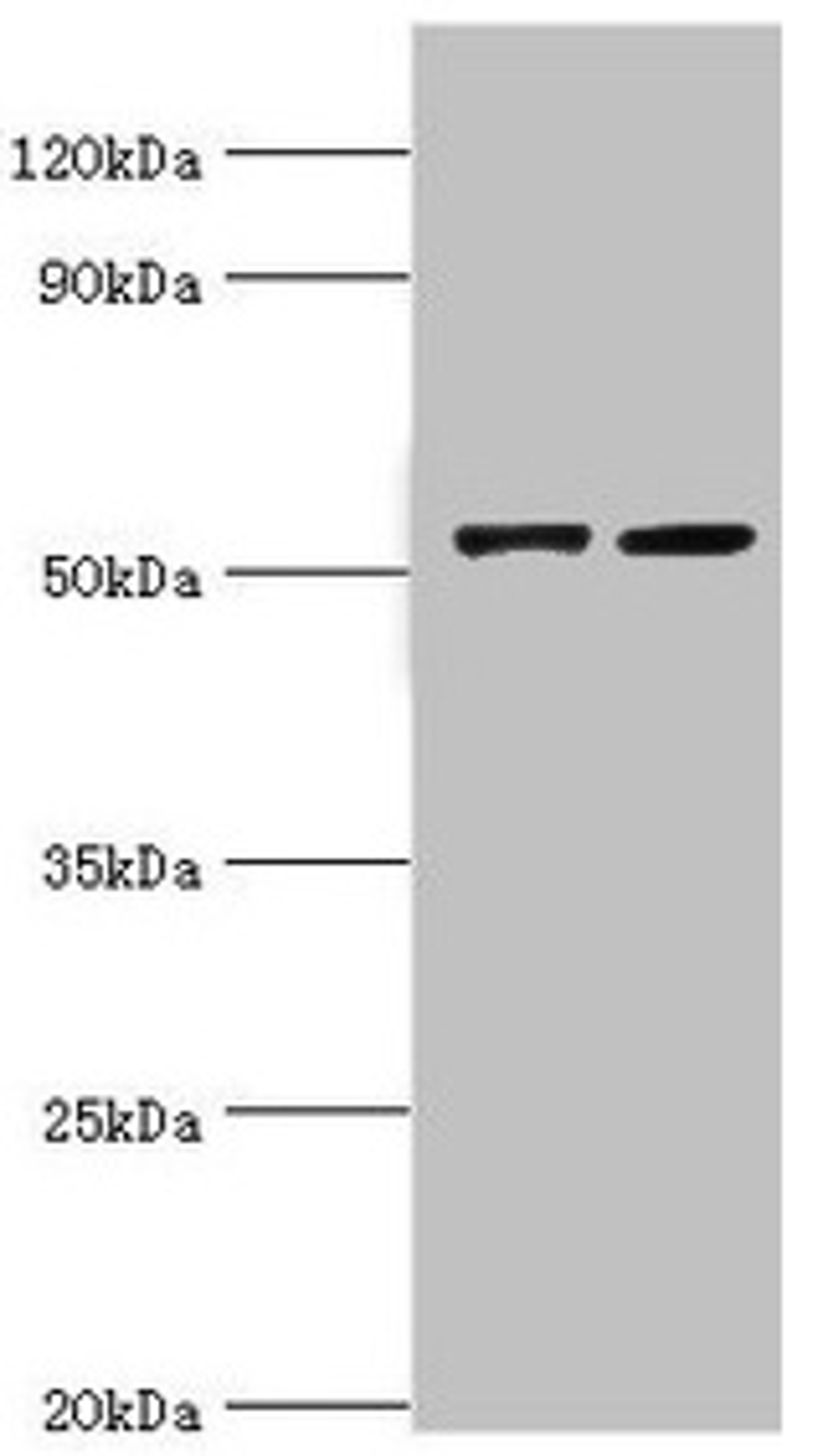 Western blot. All lanes: CBLC antibody at 14µg/ml. Lane 1: A549 whole cell lysate. Lane 2: Hela whole cell lysate. Secondary. Goat polyclonal to rabbit IgG at 1/10000 dilution. Predicted band size: 53, 48 kDa. Observed band size: 53 kDa