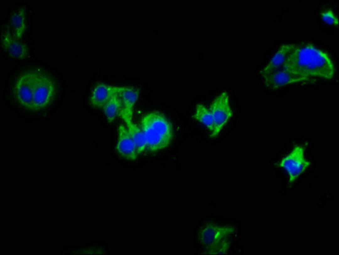 Immunofluorescence staining of HepG2 cells with CSB-PA872509LA01HU at 1:333, counter-stained with DAPI. The cells were fixed in 4% formaldehyde, permeabilized using 0.2% Triton X-100 and blocked in 10% normal Goat Serum. The cells were then incubated with the antibody overnight at 4°C. The secondary antibody was Alexa Fluor 488-congugated AffiniPure Goat Anti-Rabbit IgG(H+L).