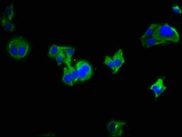 Immunofluorescence staining of HepG2 cells with CSB-PA872509LA01HU at 1:333, counter-stained with DAPI. The cells were fixed in 4% formaldehyde, permeabilized using 0.2% Triton X-100 and blocked in 10% normal Goat Serum. The cells were then incubated with the antibody overnight at 4°C. The secondary antibody was Alexa Fluor 488-congugated AffiniPure Goat Anti-Rabbit IgG(H+L).