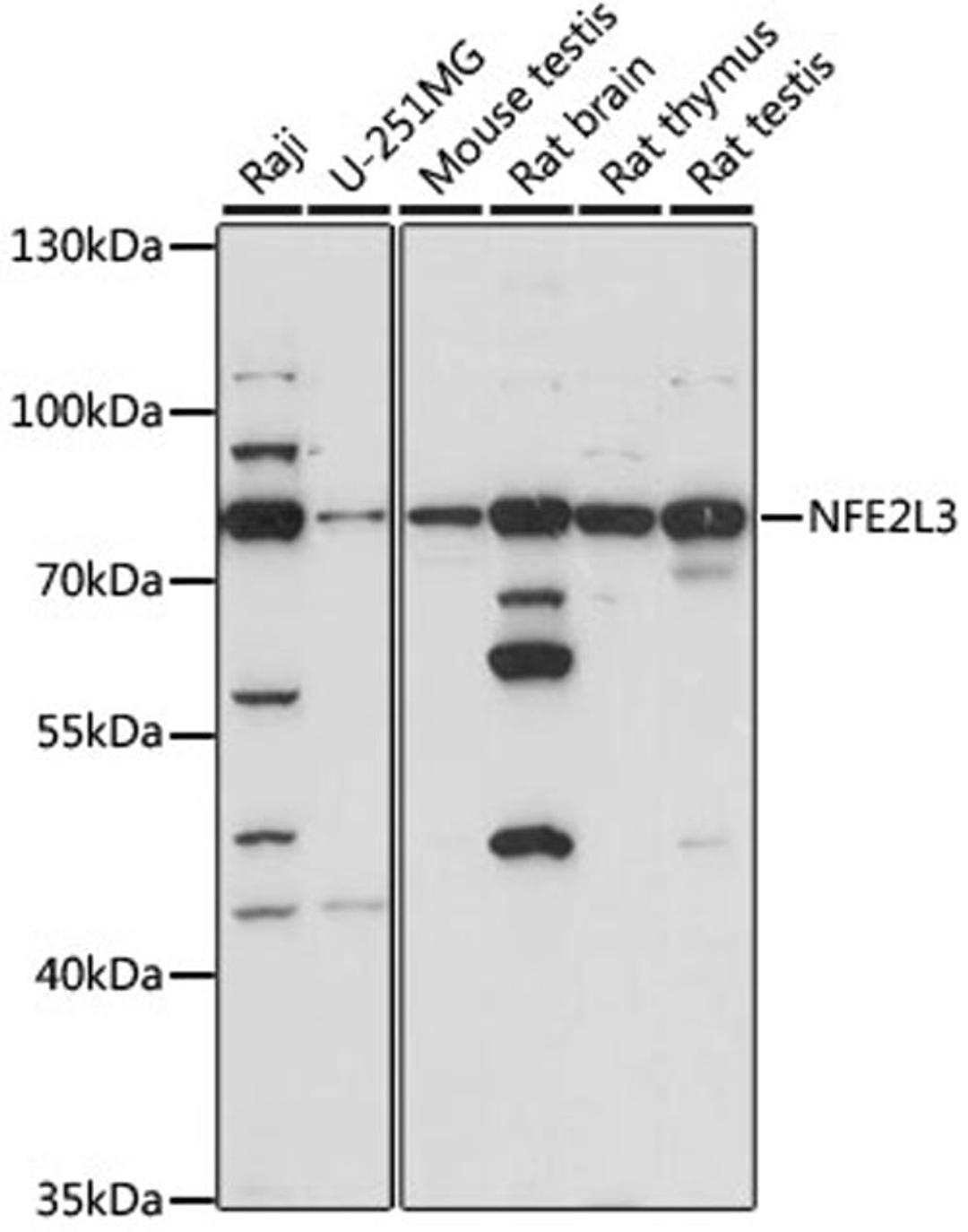 Western blot - NFE2L3 antibody (A15761)