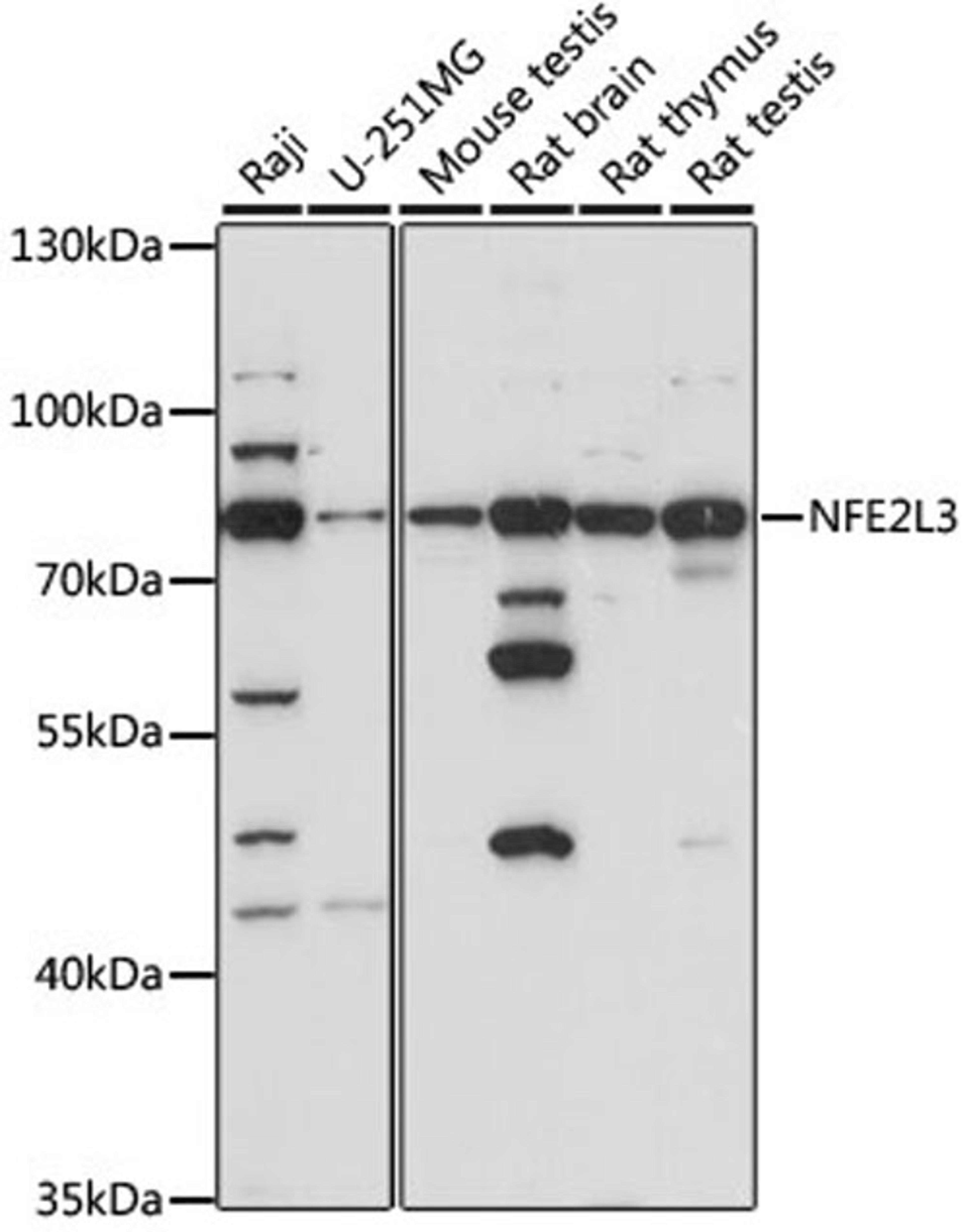 Western blot - NFE2L3 antibody (A15761)