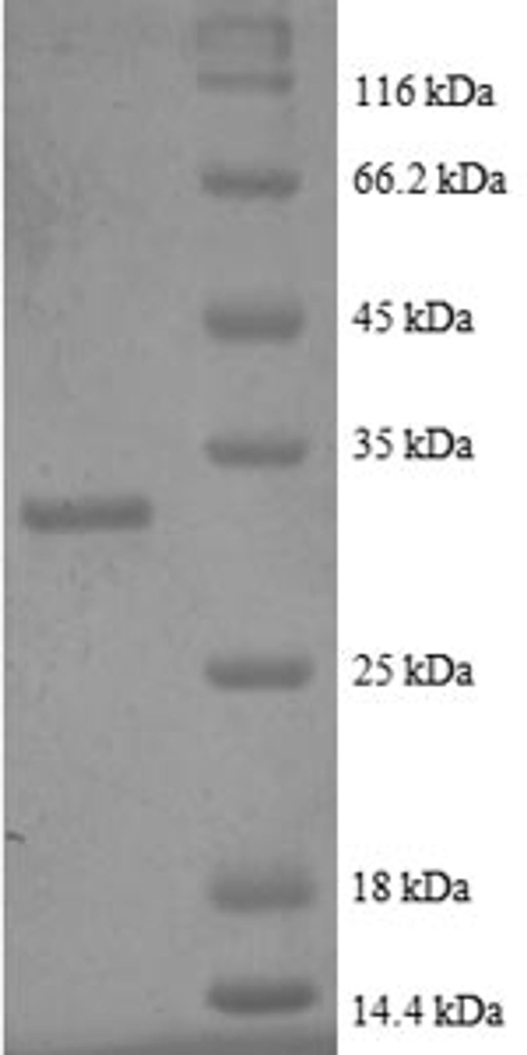 (Tris-Glycine gel) Discontinuous SDS-PAGE (reduced) with 5% enrichment gel and 15% separation gel.
