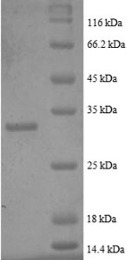 (Tris-Glycine gel) Discontinuous SDS-PAGE (reduced) with 5% enrichment gel and 15% separation gel.