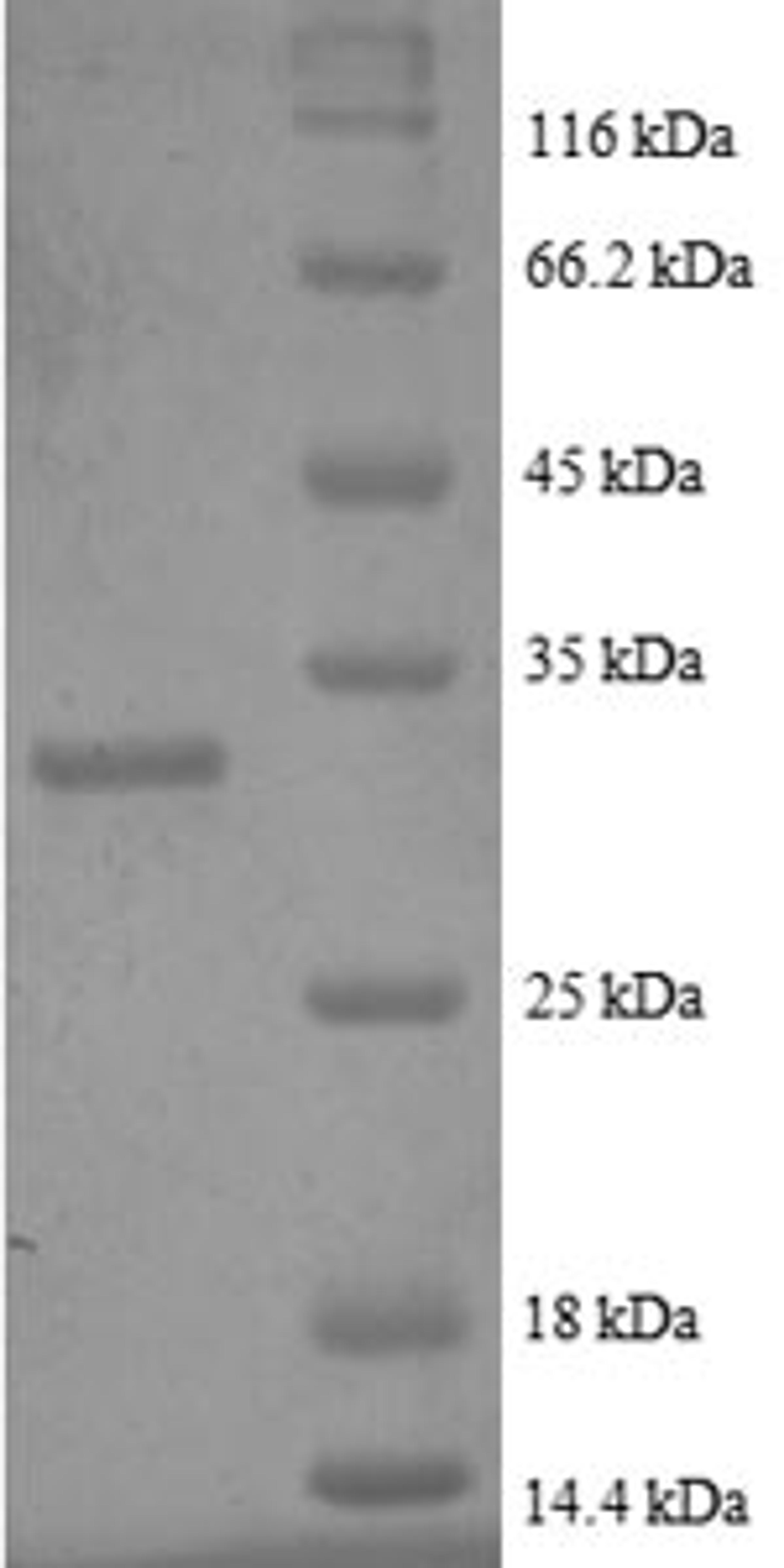(Tris-Glycine gel) Discontinuous SDS-PAGE (reduced) with 5% enrichment gel and 15% separation gel.