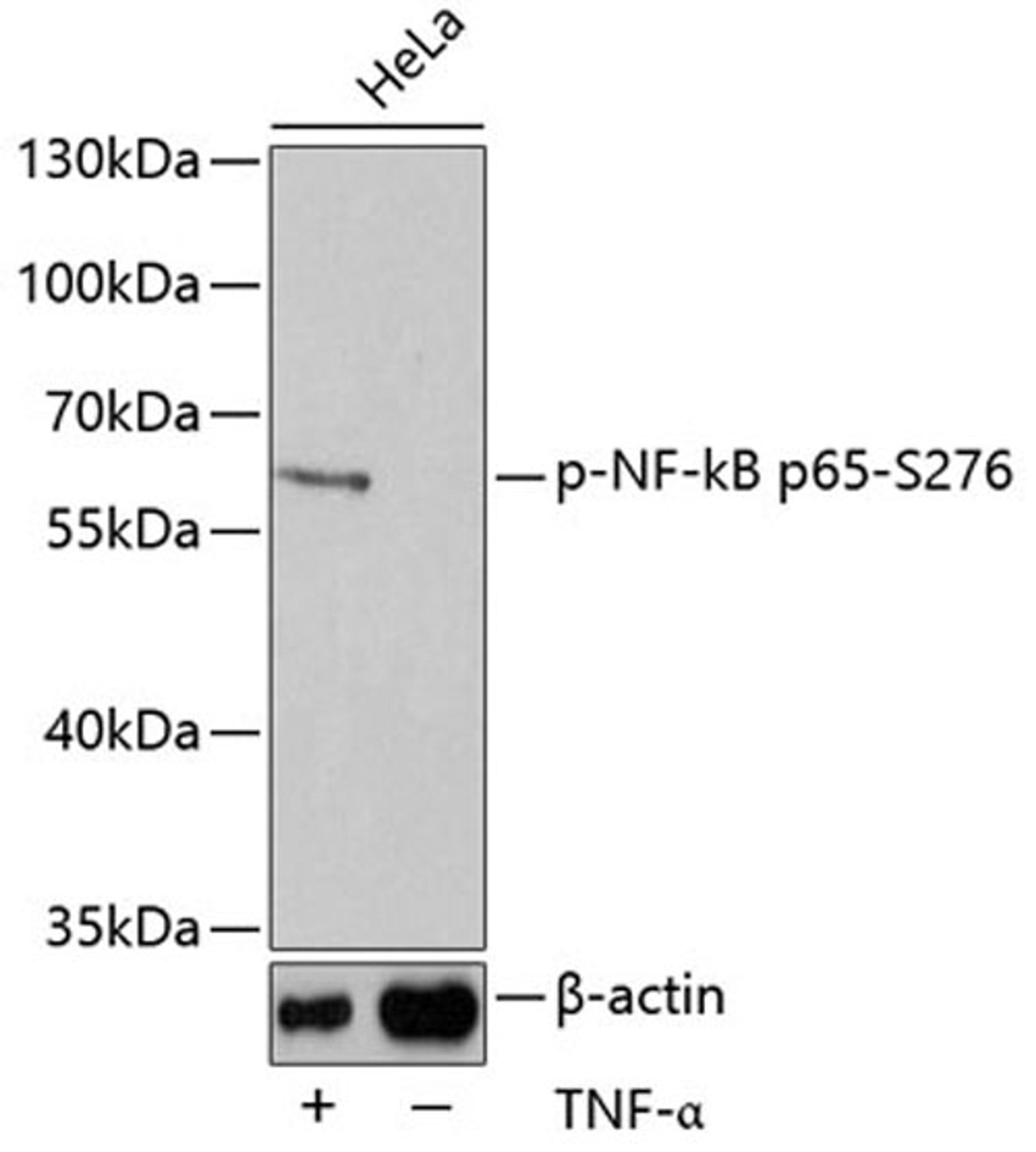 Western blot - Phospho-NF-kB p65-S276 antibody (AP0123)