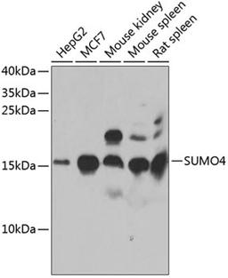 Western blot - SUMO4 antibody (A7517)