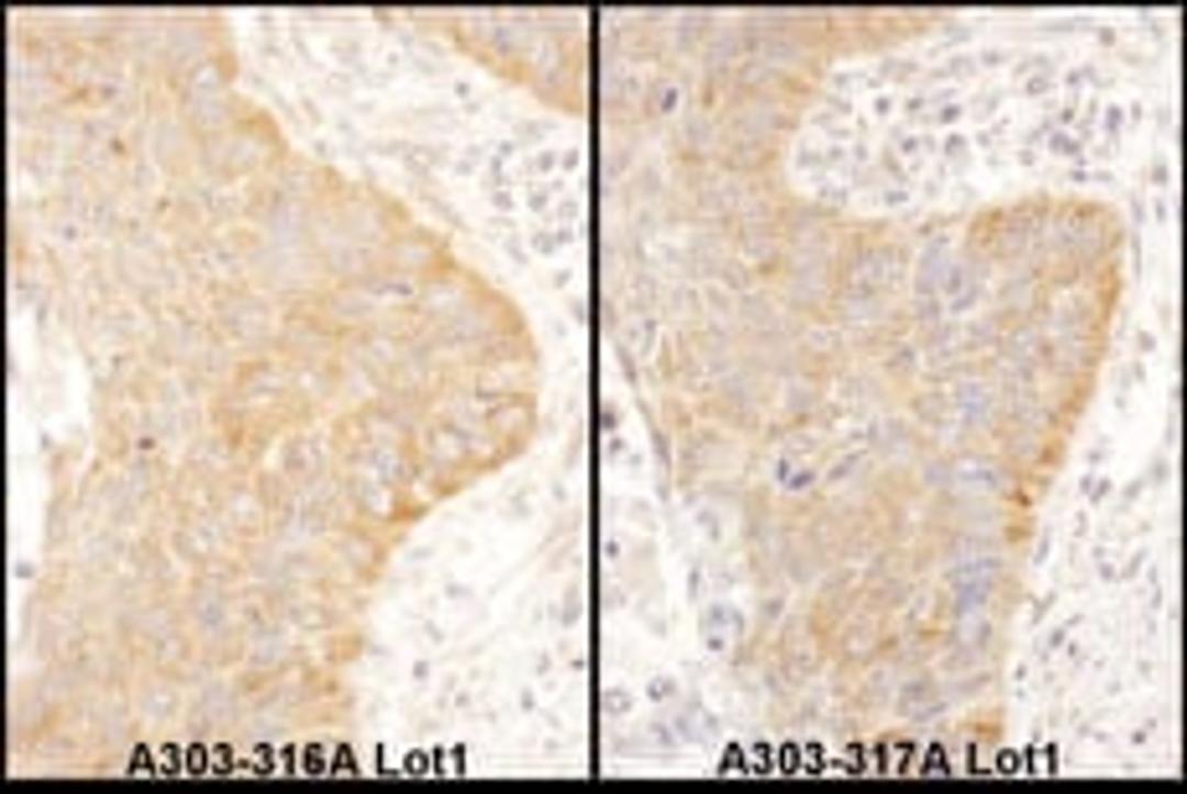 Detection of human IGF2BP2 by immunohistochemistry.