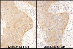 Detection of human IGF2BP2 by immunohistochemistry.