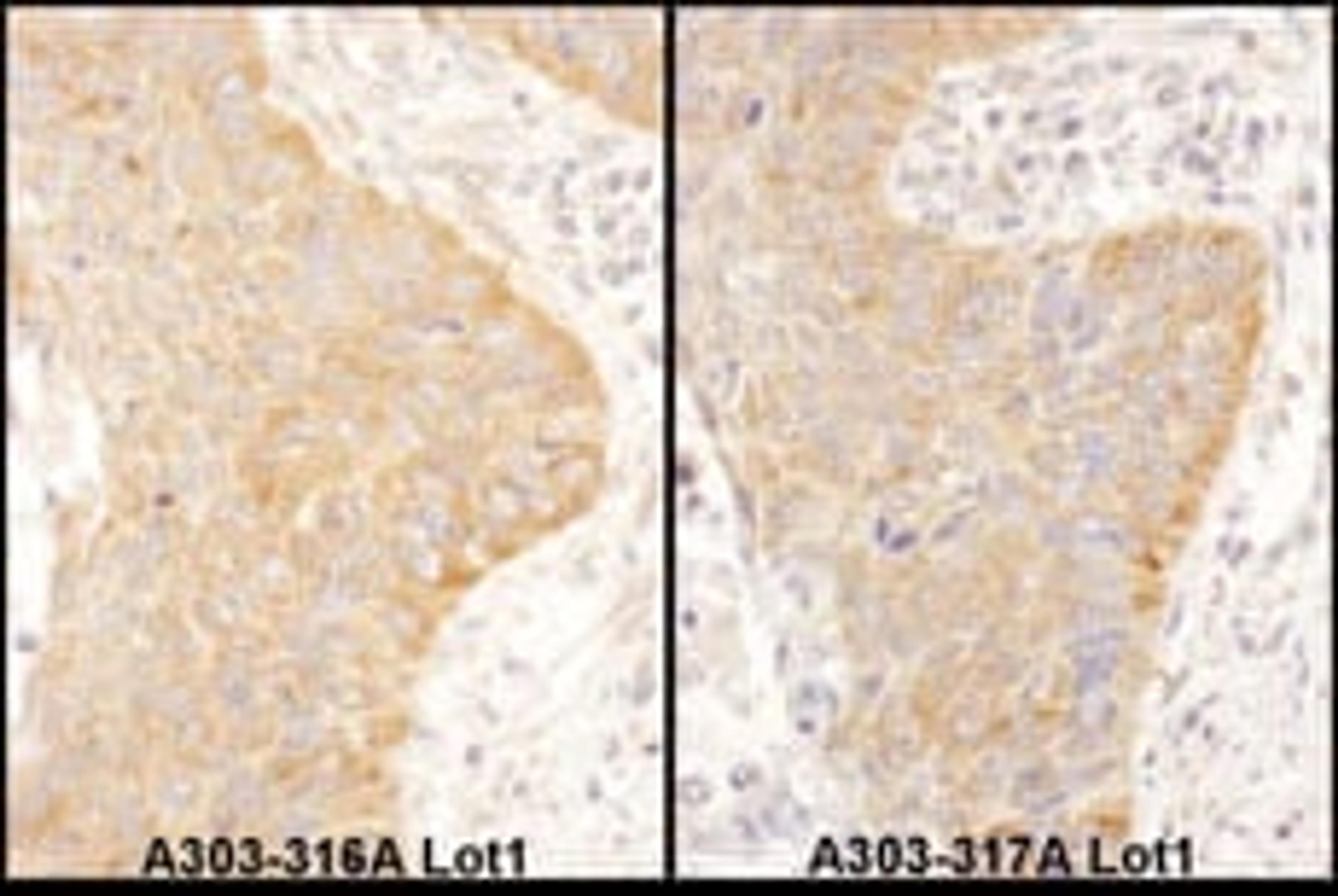 Detection of human IGF2BP2 by immunohistochemistry.