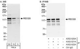 Detection of human RECQ5 by western blot and immunoprecipitation.