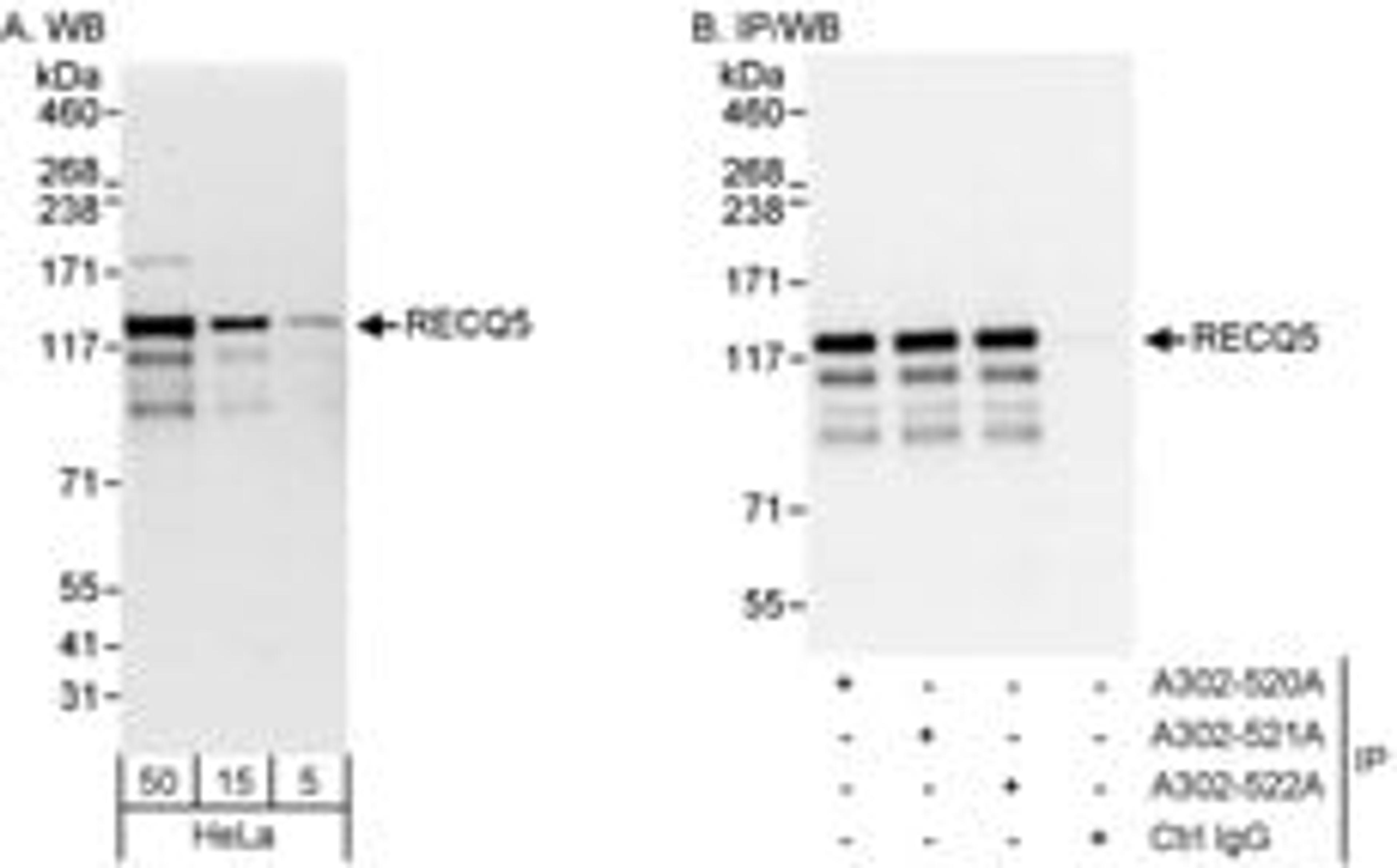 Detection of human RECQ5 by western blot and immunoprecipitation.