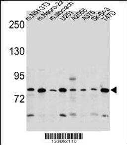 Western blot analysis in mouse NIH-3T3,Neuro-2a cell line and mouse stomach tissue and U251,A2058,A375,Sk-Br-3,T47D cell line lysates (35ug/lane).