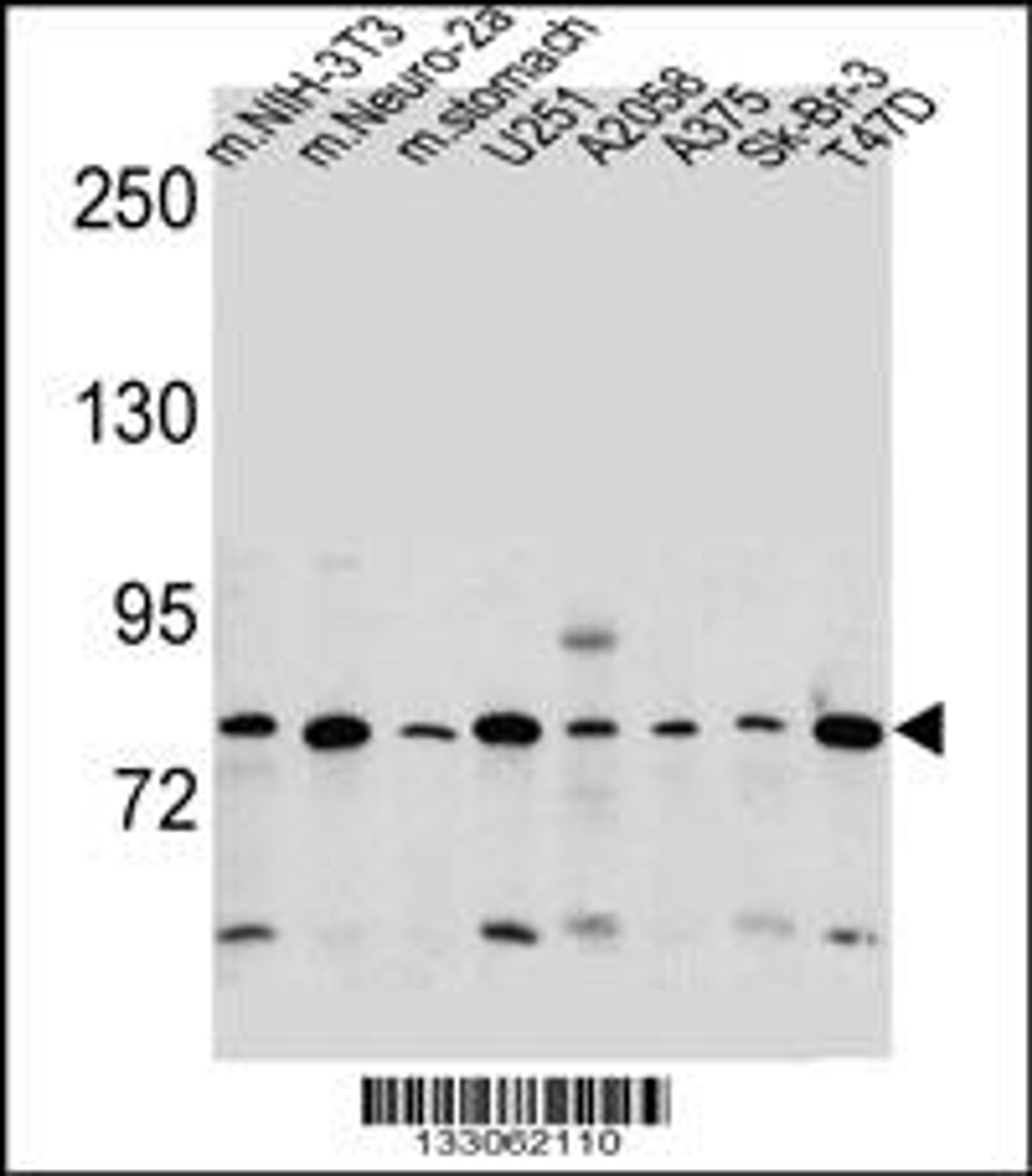 Western blot analysis in mouse NIH-3T3,Neuro-2a cell line and mouse stomach tissue and U251,A2058,A375,Sk-Br-3,T47D cell line lysates (35ug/lane).