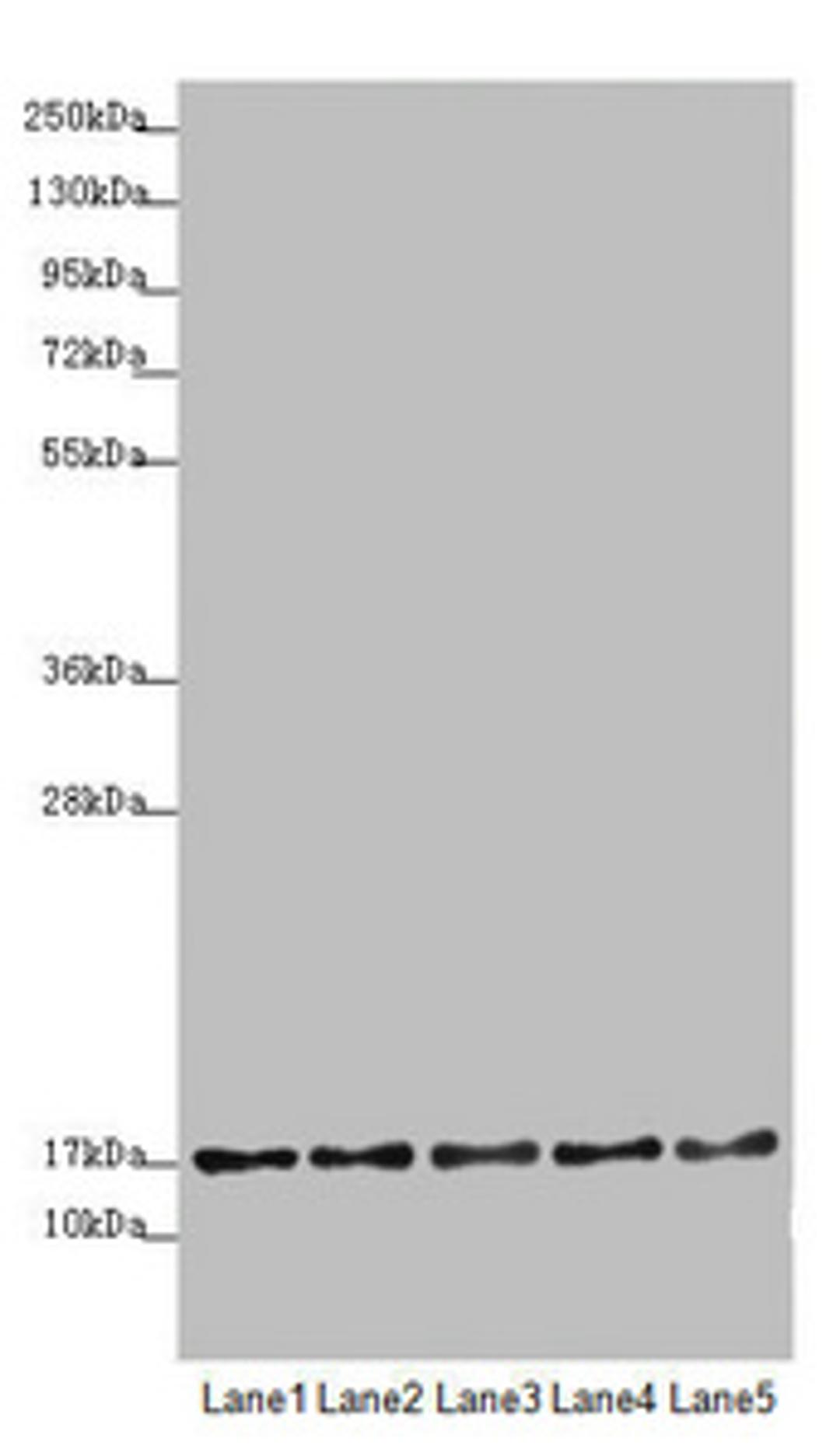 Western blot. All lanes: TIMM17B antibody at 1.75 ug/ml. Lane 1: U251 whole cell lysate. Lane 2: Jurkat whole cell lysate. Lane 3: HepG2 whole cell lysate. Lane 4: HL60 whole cell lysate. Lane 5: A431 whole cell lysate. Secondary. Goat polyclonal to rabbit IgG at 1/10000 dilution. Predicted band size: 19, 24 kDa. Observed band size: 19 kDa. 