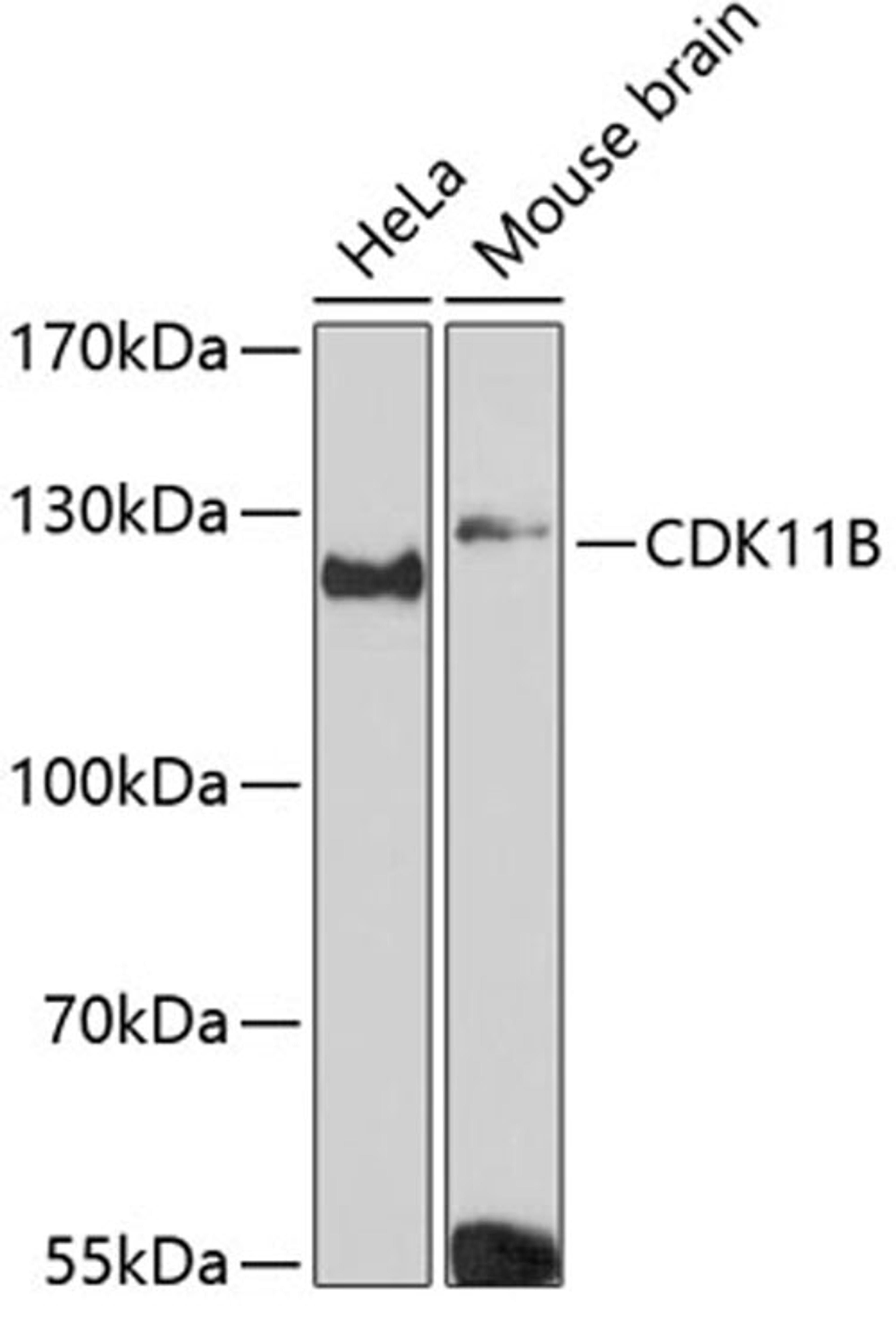 Western blot - CDK11B Antibody (A12830)