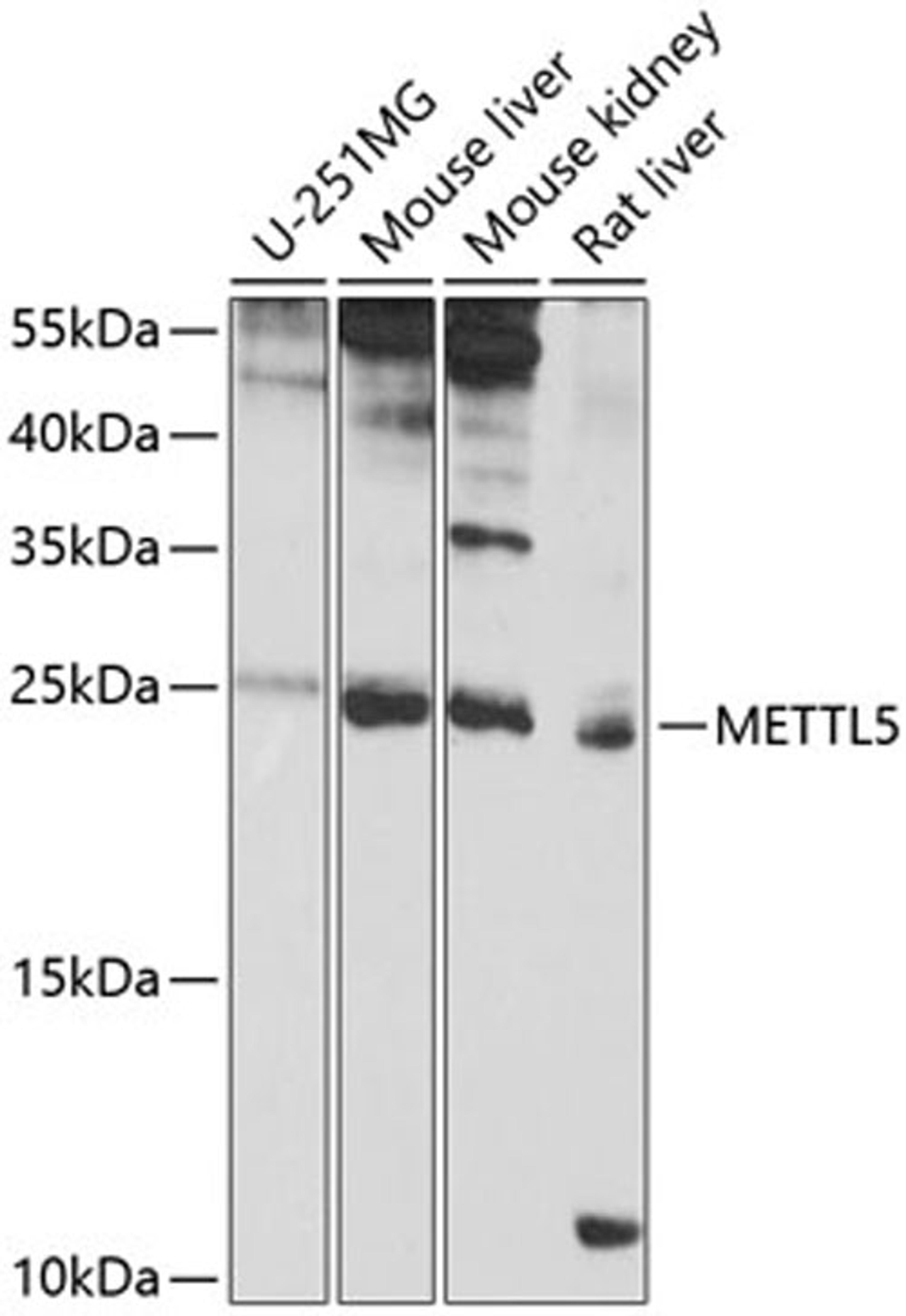 Western blot - METTL5 antibody (A9217)