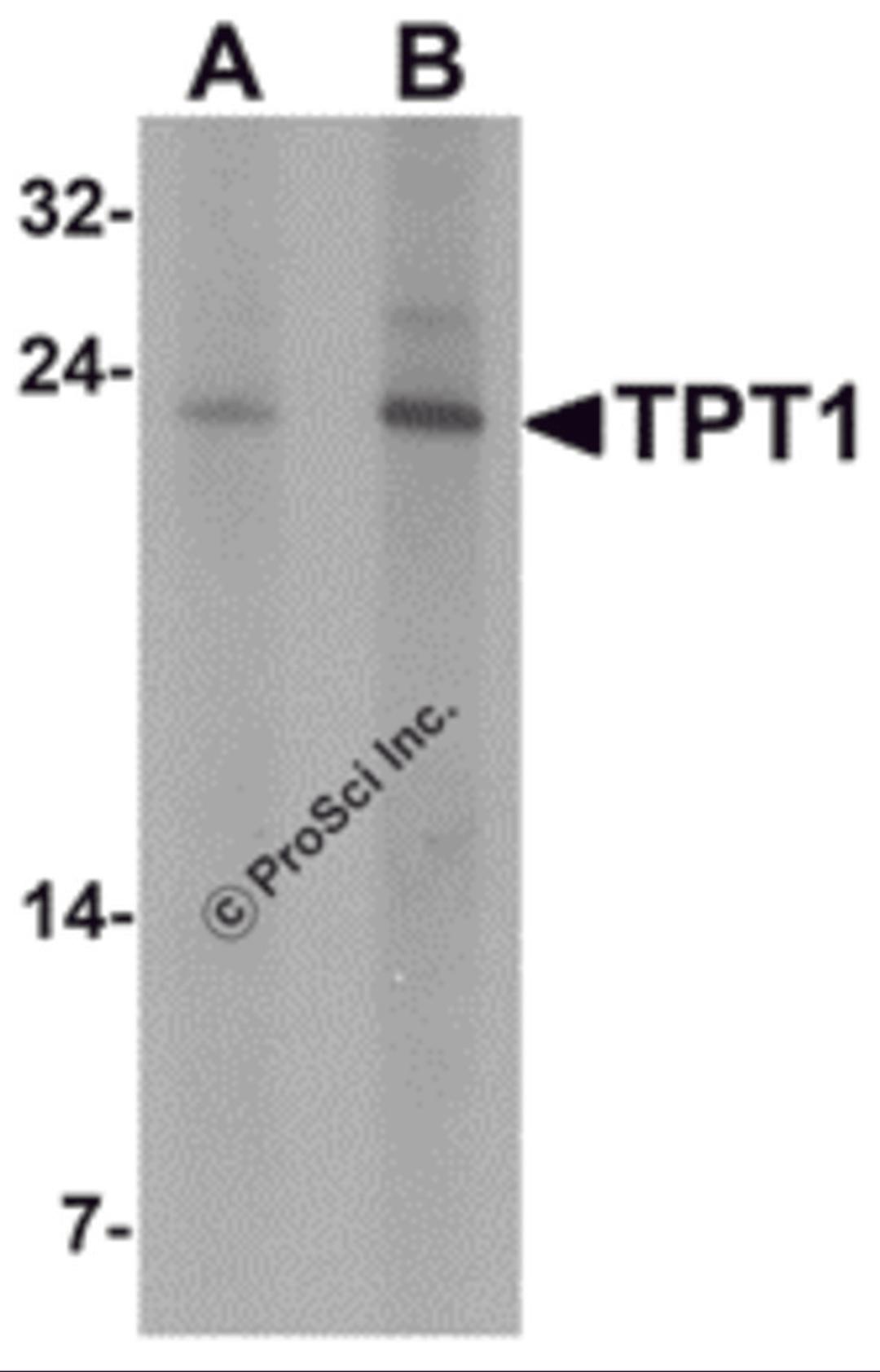 Western blot analysis of TPT1 in human brain tissue lysate with TPT1 antibody at (A) 0.5 and (B) 1 μg/mL.