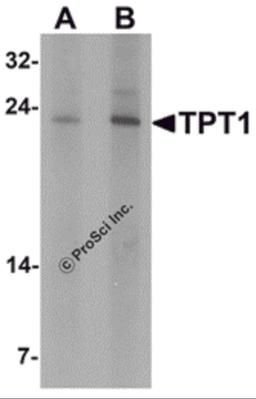 Western blot analysis of TPT1 in human brain tissue lysate with TPT1 antibody at (A) 0.5 and (B) 1 μg/mL.