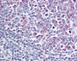 Immunohistochemistry-Paraffin: GPR65 Antibody [NBP2-24487] - Analysis of human tonsil using GPR65 antibody at 20 ug/ml.