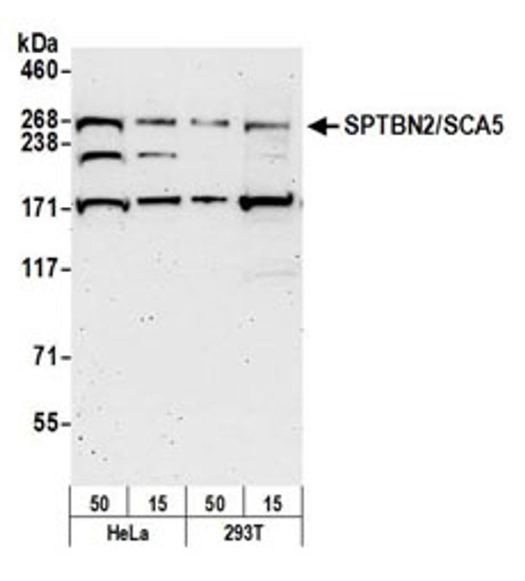 Detection of human SPTBN2/SCA5 by western blot.