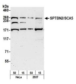 Detection of human SPTBN2/SCA5 by western blot.