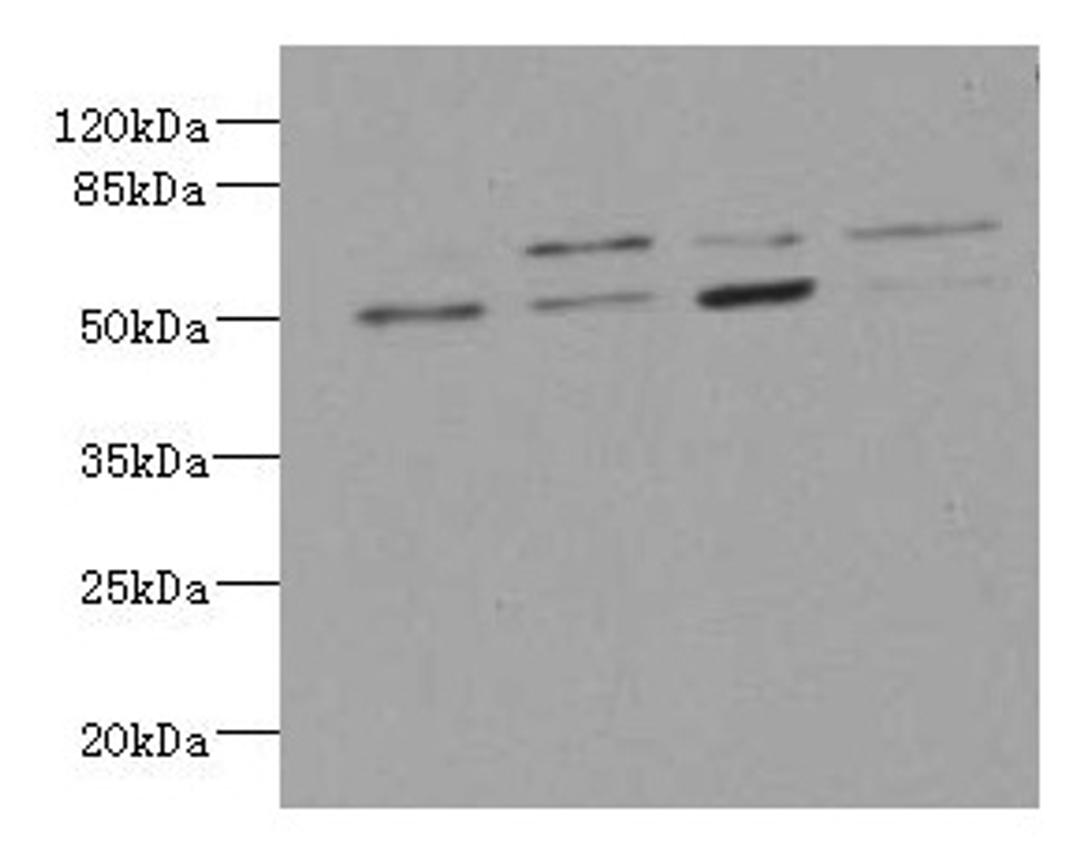 Western blot. All lanes: LDB3 antibody at 3.21ug/ml. Lane 1 : Hela whole cell lysate. Lane 2 : Raji whole cell lysate. Lane 3 : MCF-7 whole cell lysate. Lane 4 : A431 whole cell lysate. Secondary. Goat polyclonal to rabbit IgG at 1/10000 dilution. Predicted band size: 78, 67, 51, 43, 36, 31, 79 kDa. Observed band size: 67, 51 kDa