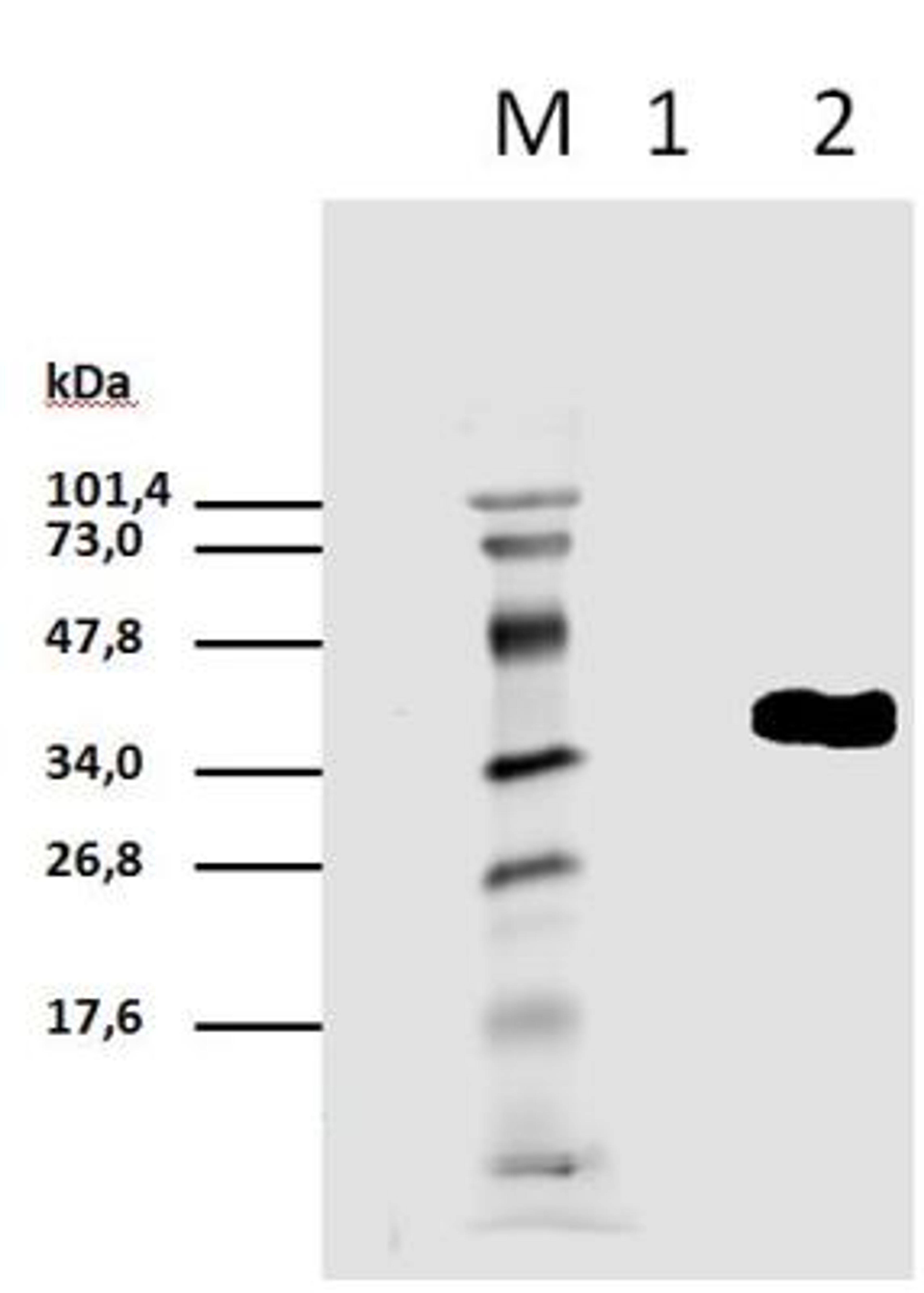 Western Blot: CD3 zeta [p tyr 111] Antibody (EM-55) [NBP2-37709] - Analysis in lysates of HEK293T/17 cells transiently transfected with expression vector harboring gene for mCD3zeta. Lane 1) Unstimulated cells, Lane 2) Pervanadate-stimulated cells