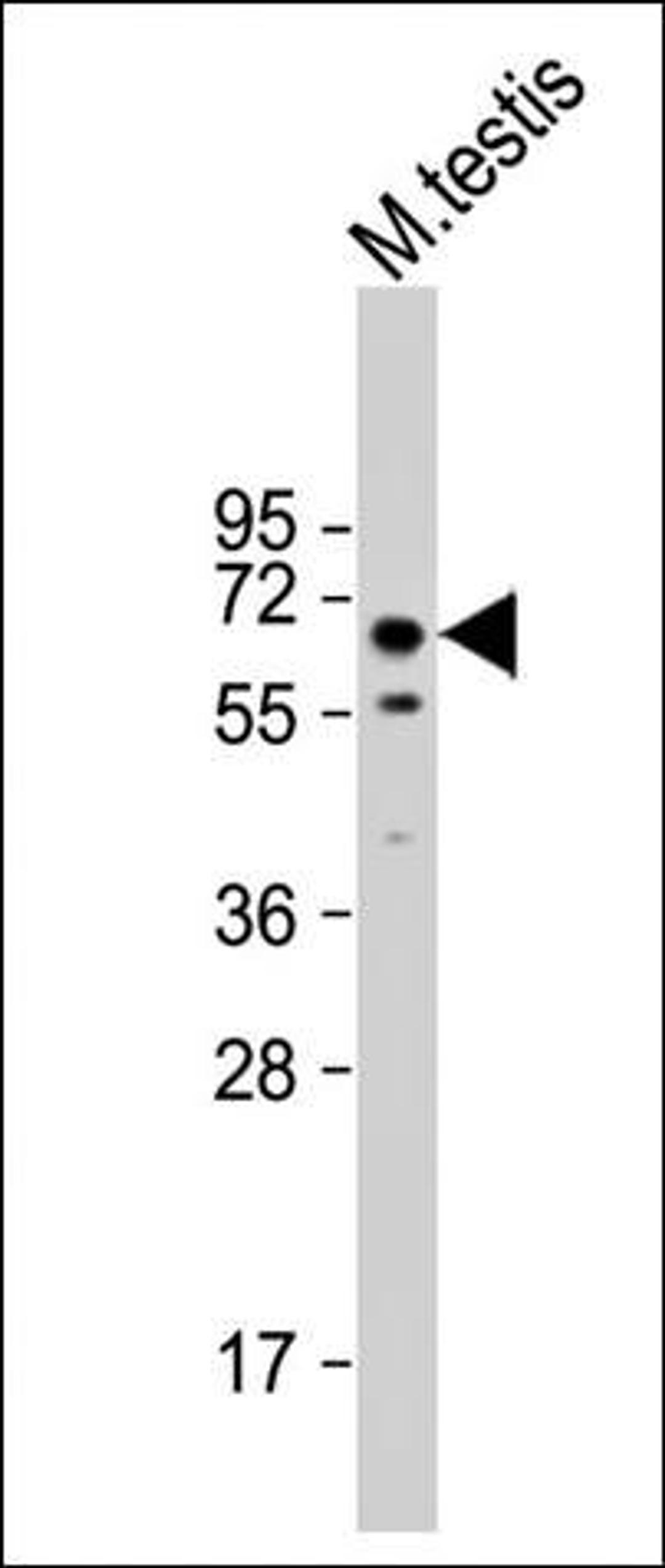 Western blot analysis of mouse testis lysate using TOR1AIP1 antibody