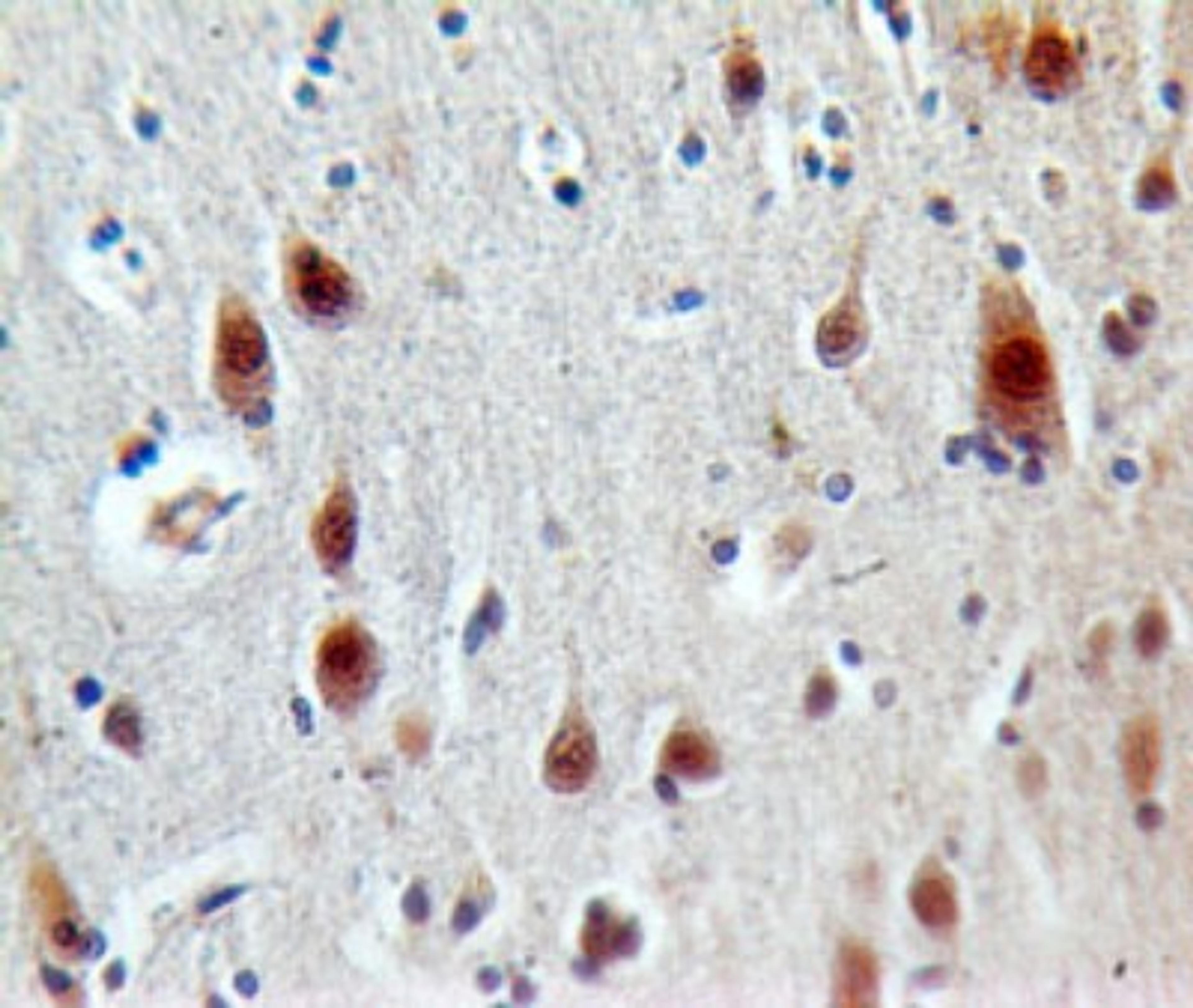 Immunohistochemistry-Paraffin: OLR1/LOX-1 Antibody [NBP2-27298] - Formalin-fixed, paraffin-embedded human brain stained with LOX-1 antibody (5 ug/ml), peroxidase-conjugate and DAB chromogen.