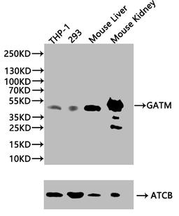 Western blot. All lanes: Glycine amidinotransferase, mitochondrial antibody at 2ug/ml + Mouse kidney tissue. Secondary. Goat polyclonal to rabbit IgG at 1/10000 dilution. Predicted band size: 49, 45 kDa. Observed band size: 49 kDa. 