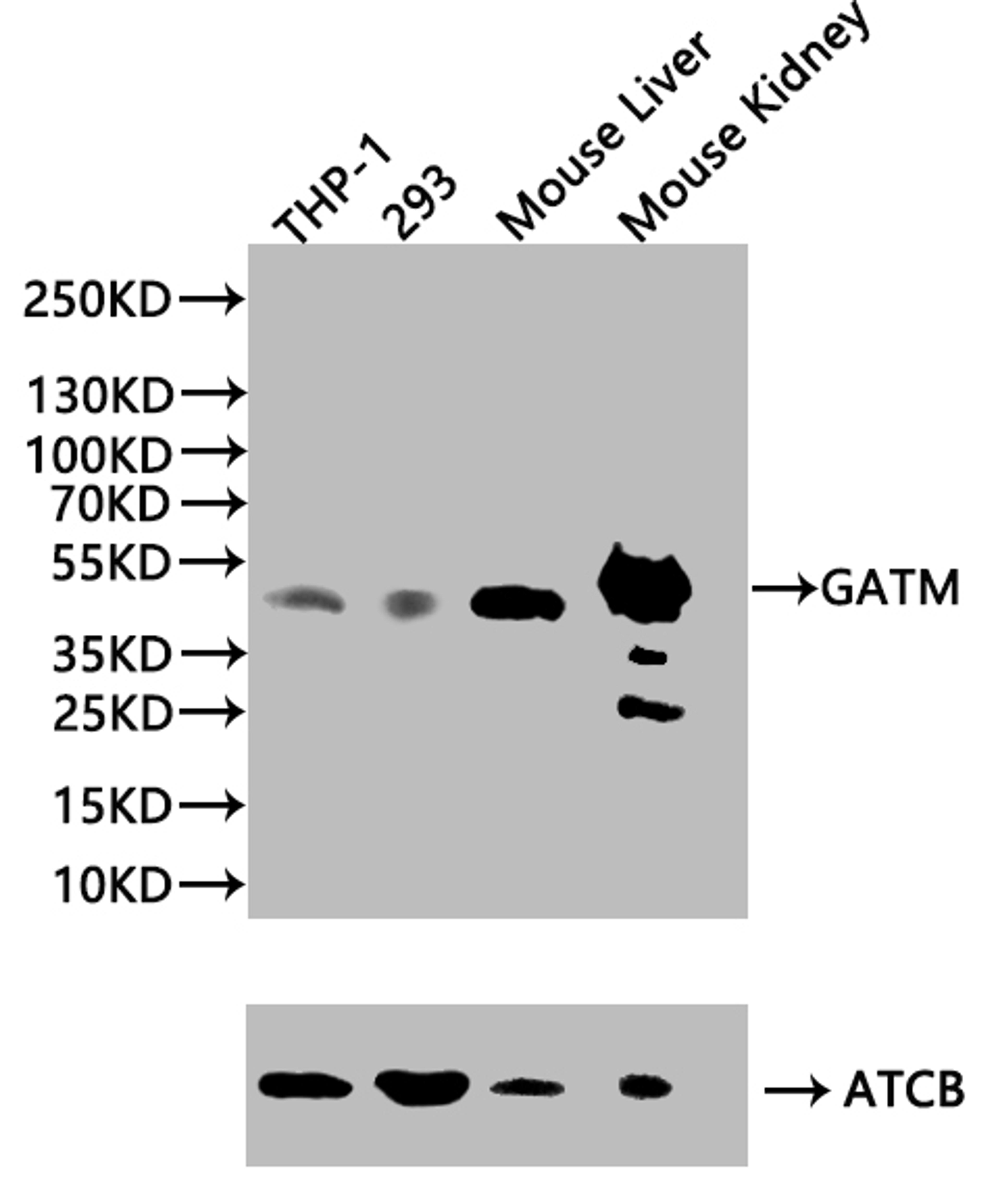 Western blot. All lanes: Glycine amidinotransferase, mitochondrial antibody at 2ug/ml + Mouse kidney tissue. Secondary. Goat polyclonal to rabbit IgG at 1/10000 dilution. Predicted band size: 49, 45 kDa. Observed band size: 49 kDa. 