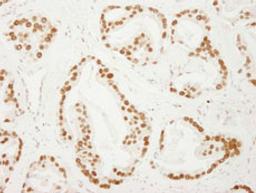 Detection of human PC4 by immunohistochemistry.