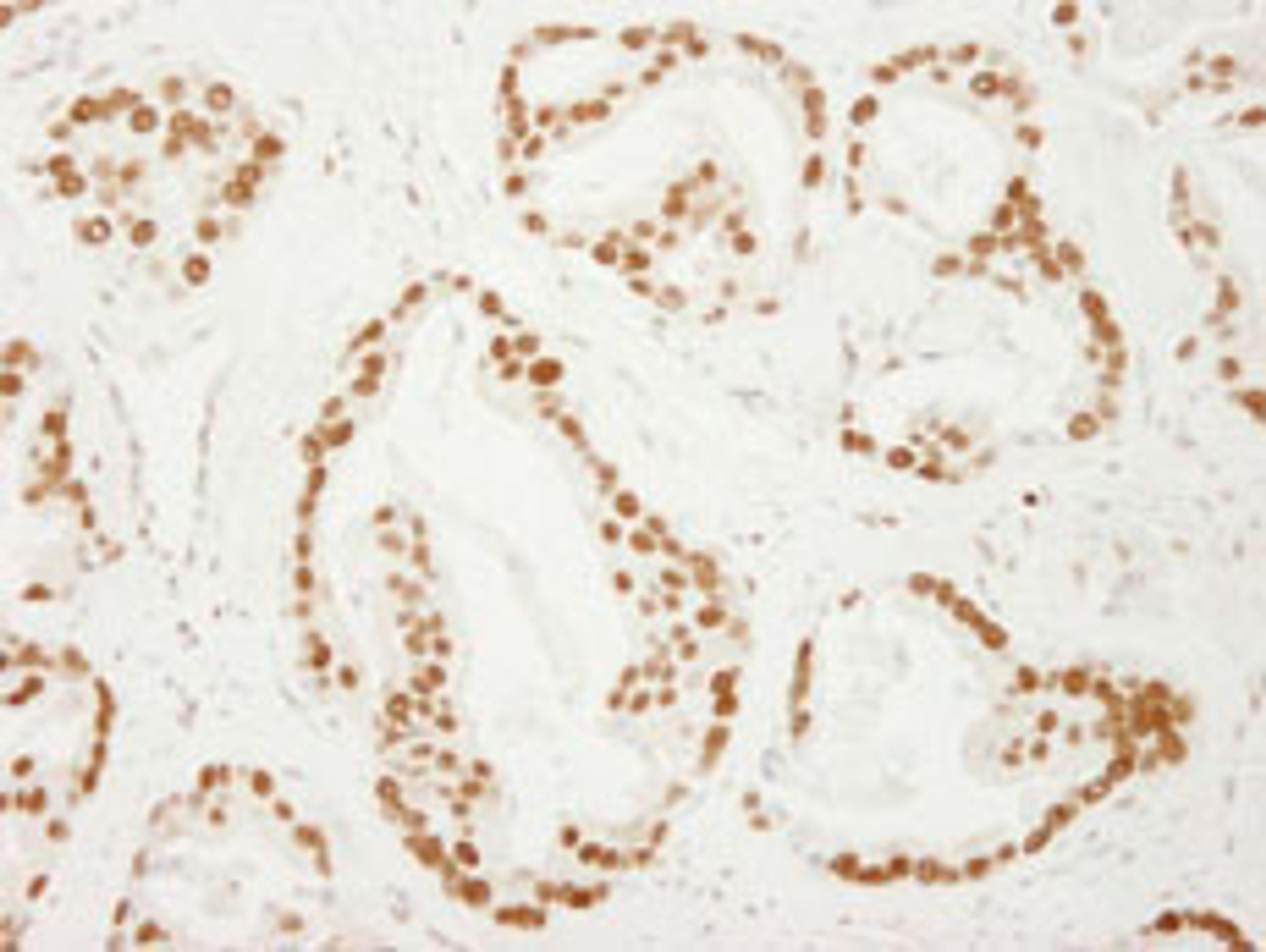 Detection of human PC4 by immunohistochemistry.