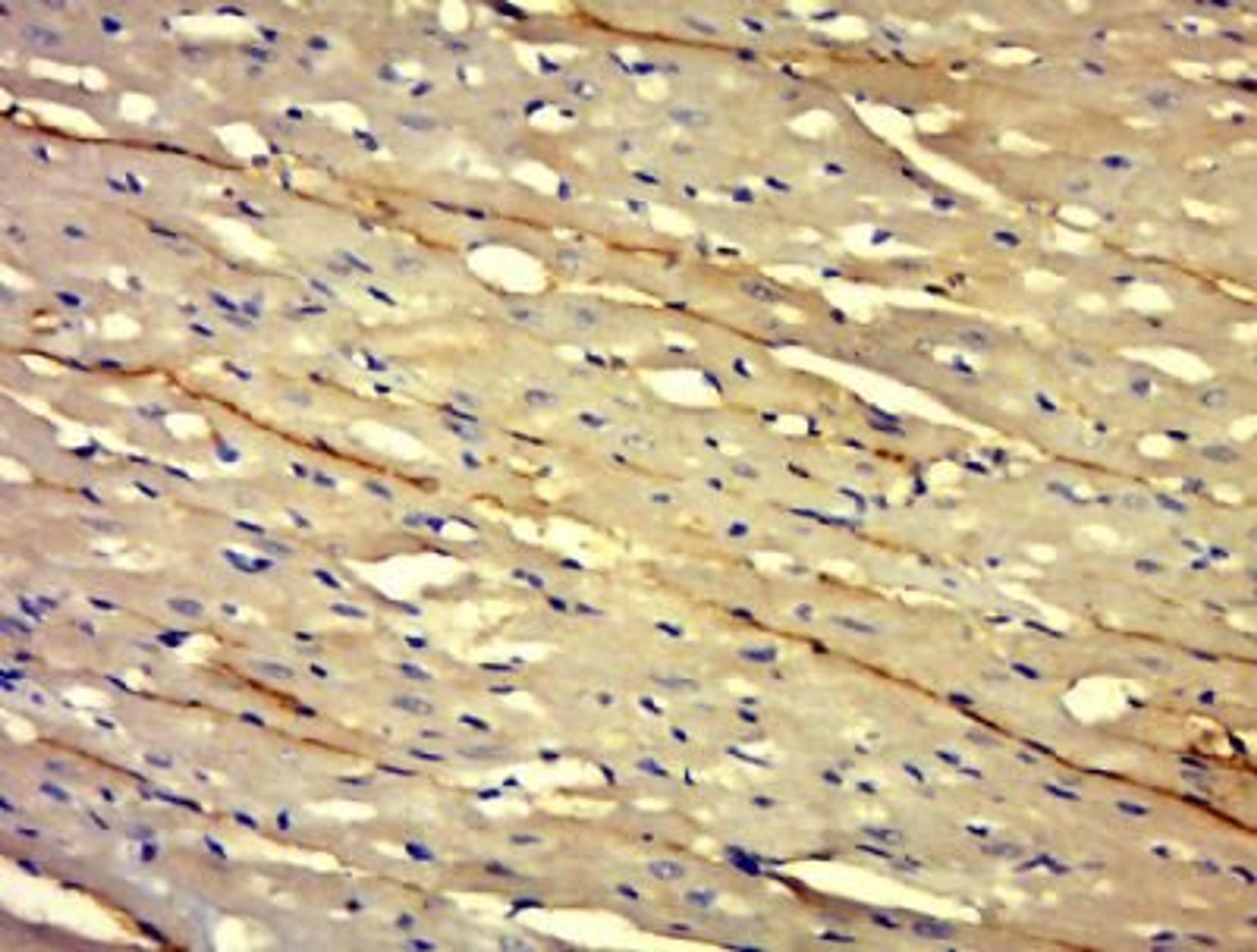 Immunohistochemical staining of Mouse brain tissue using Laminin alpha 1 antibody.