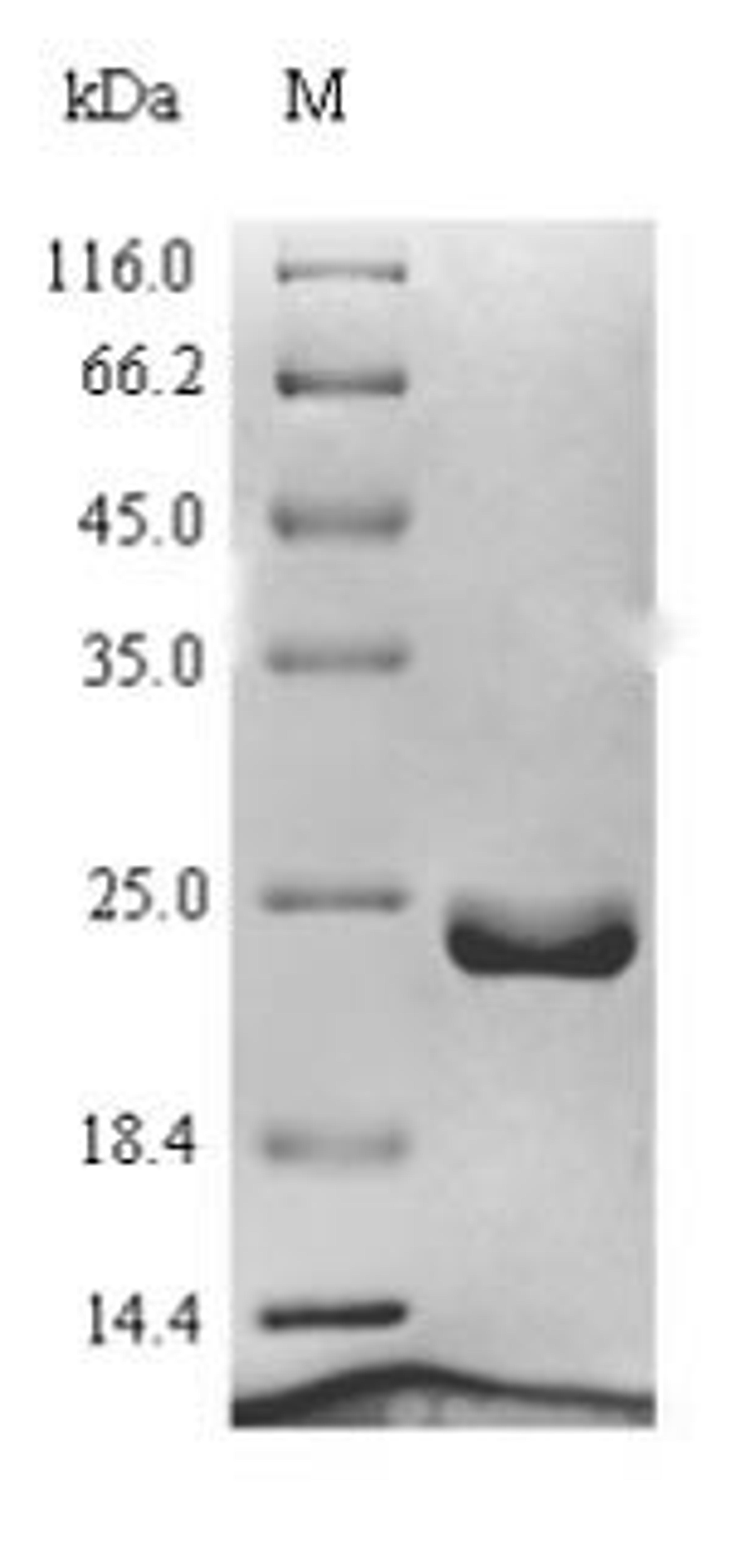 (Tris-Glycine gel) Discontinuous SDS-PAGE (reduced) with 5% enrichment gel and 15% separation gel.